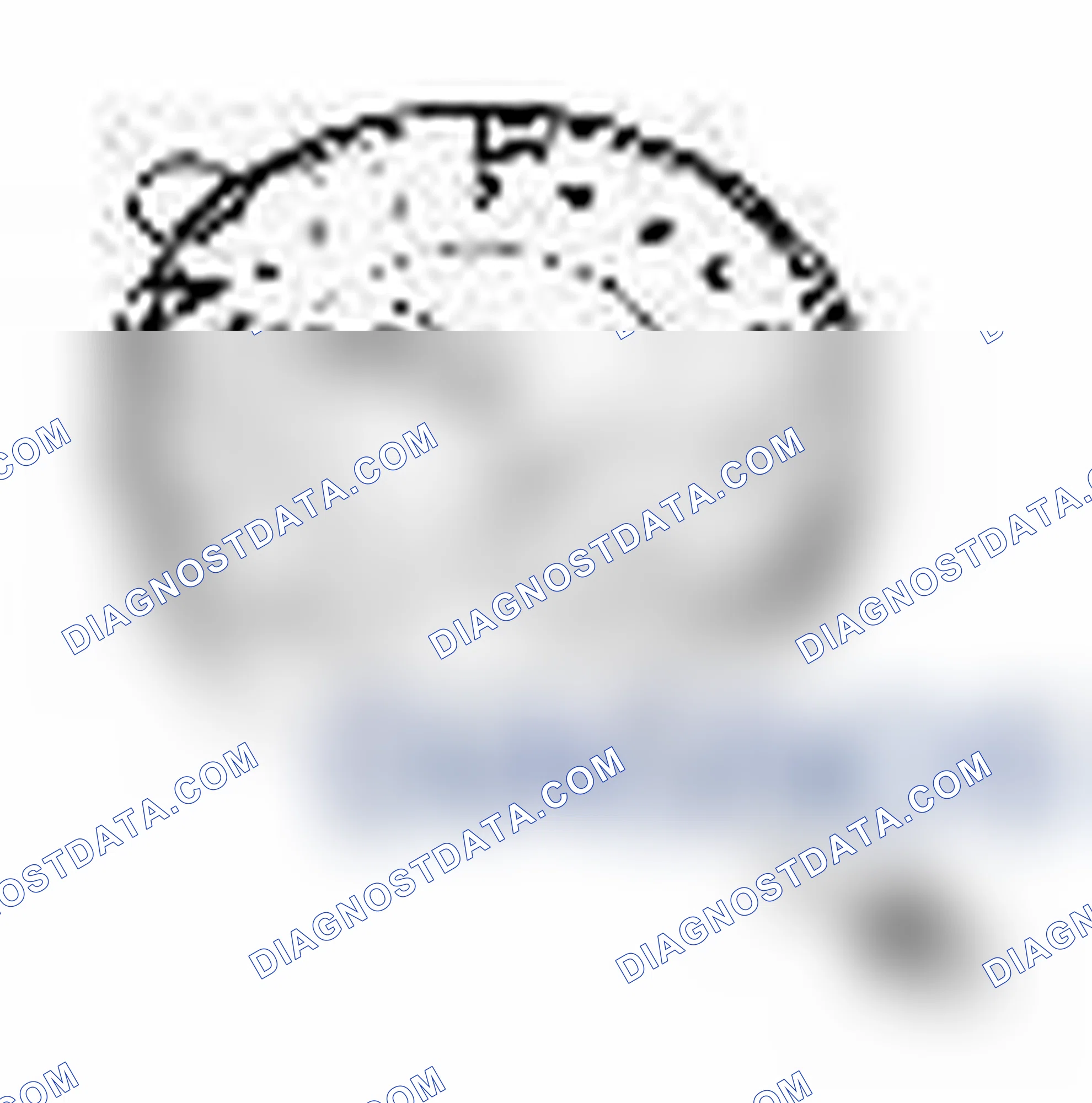 Scheme 141: Special Tool