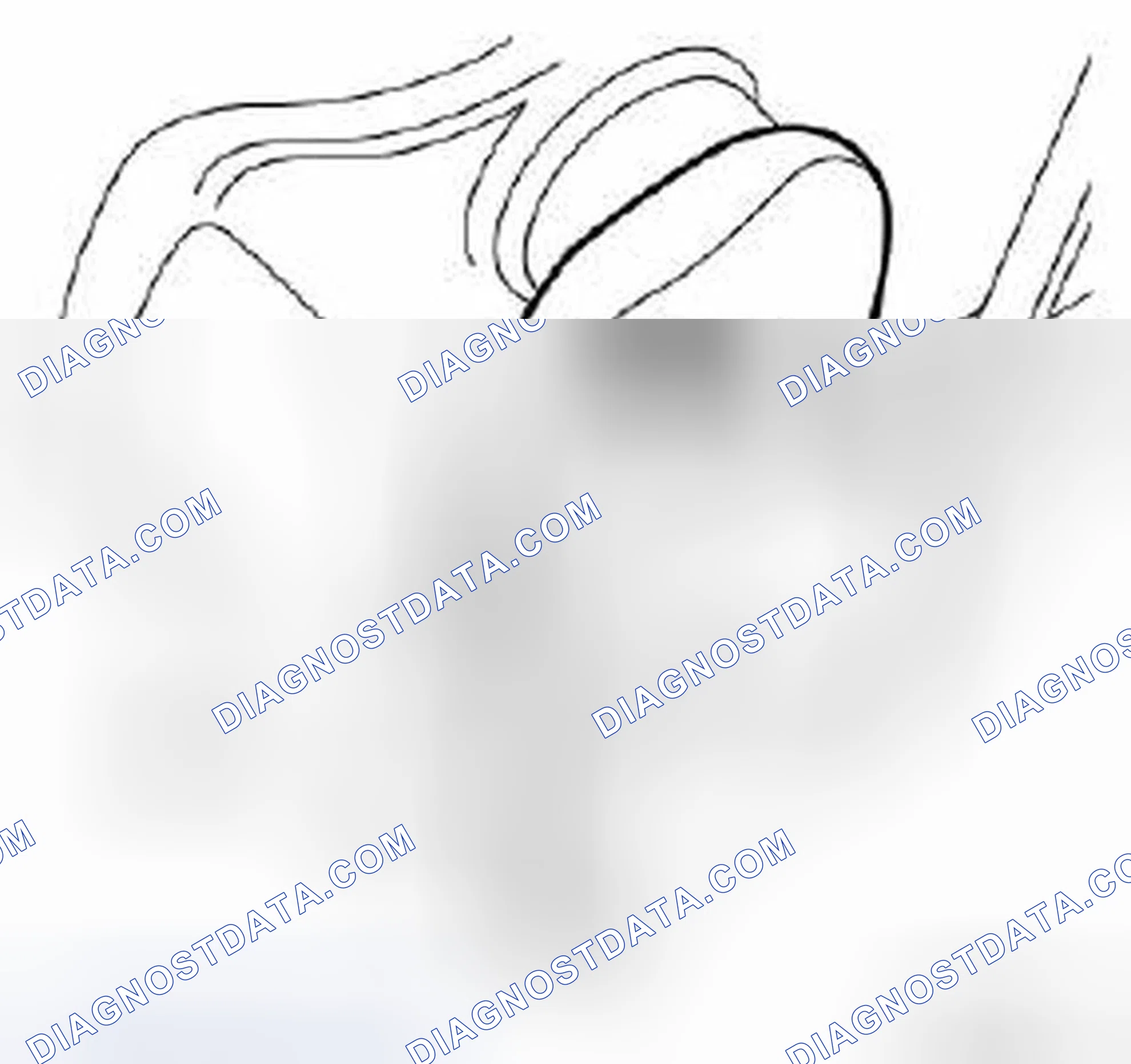 Scheme 287: Main bearings