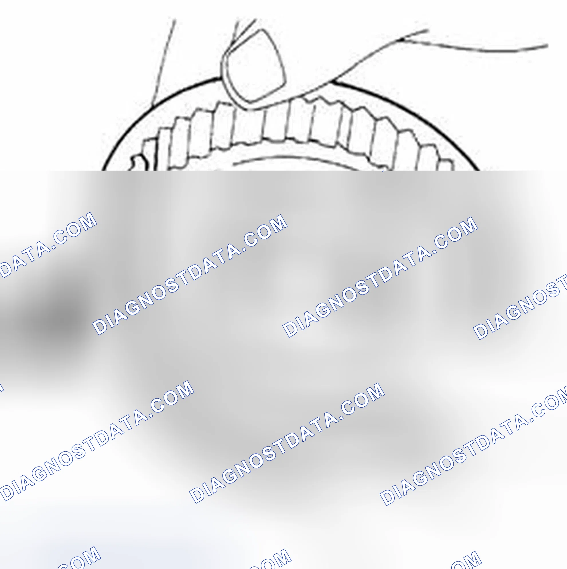 Scheme 192: Sleeve