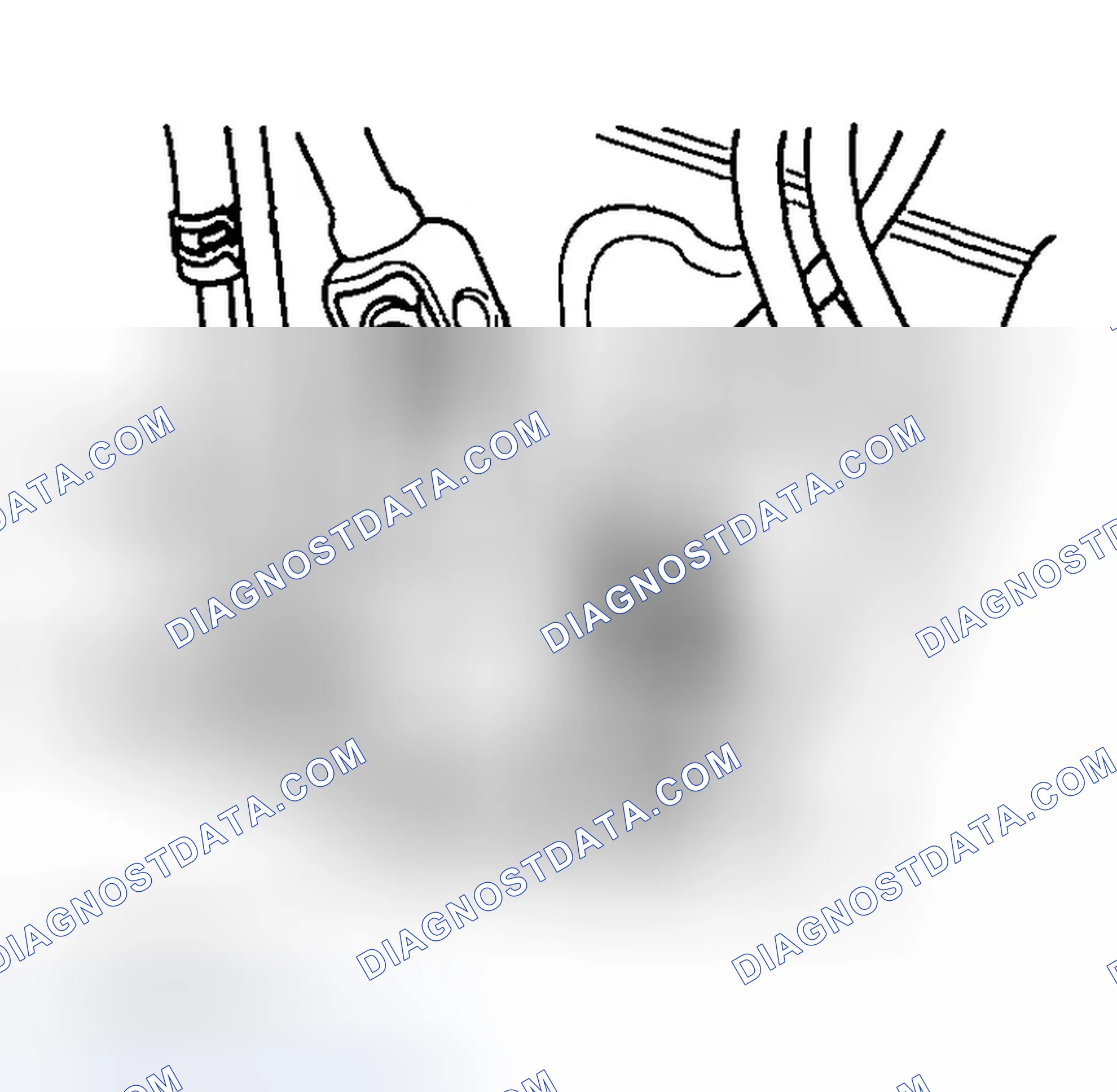 Scheme 4: EPS SOLENOID
