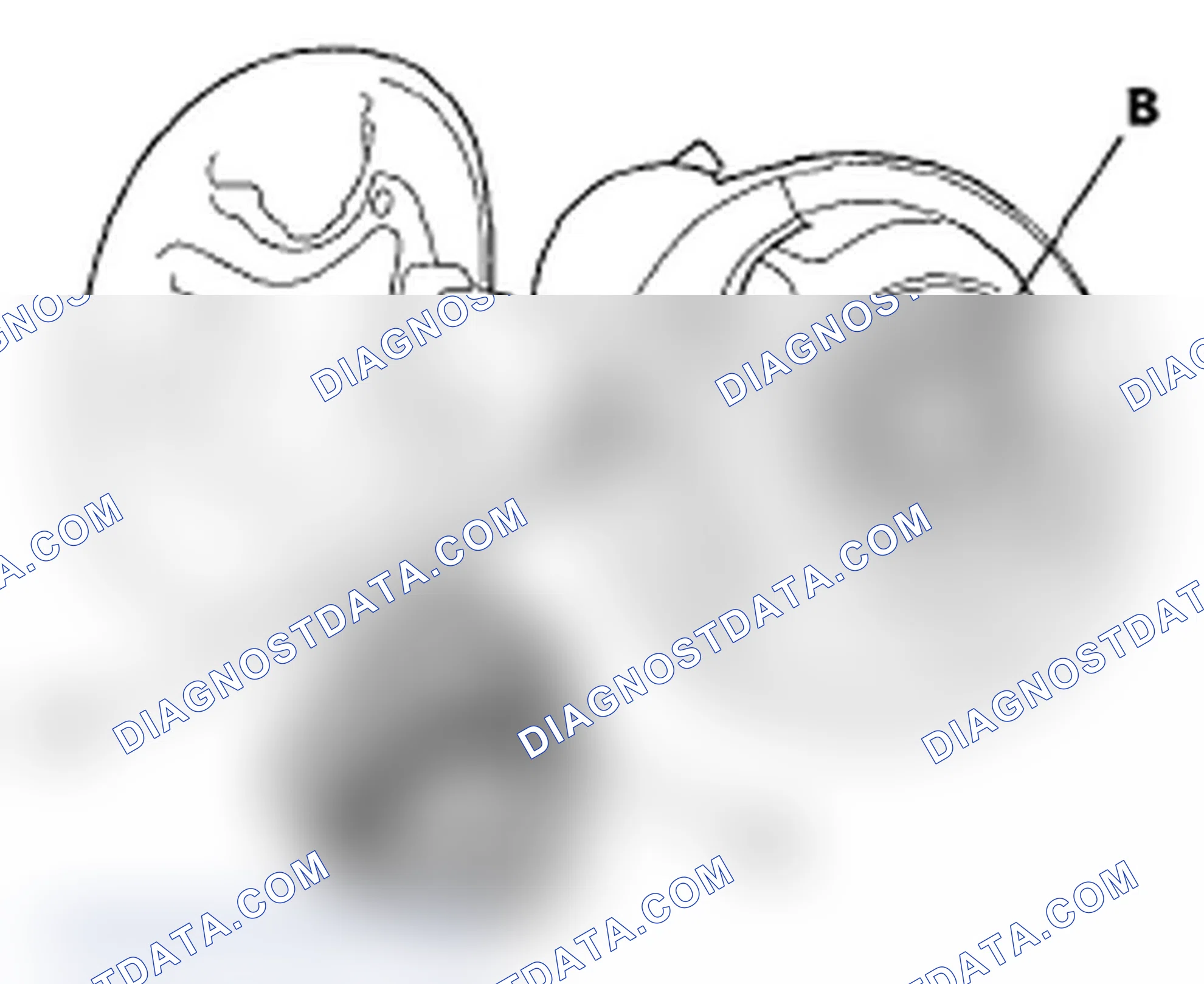 Scheme 118: DTC P0457: EVAP System Leak Detected/Fuel Fill Cap Loose or Missing