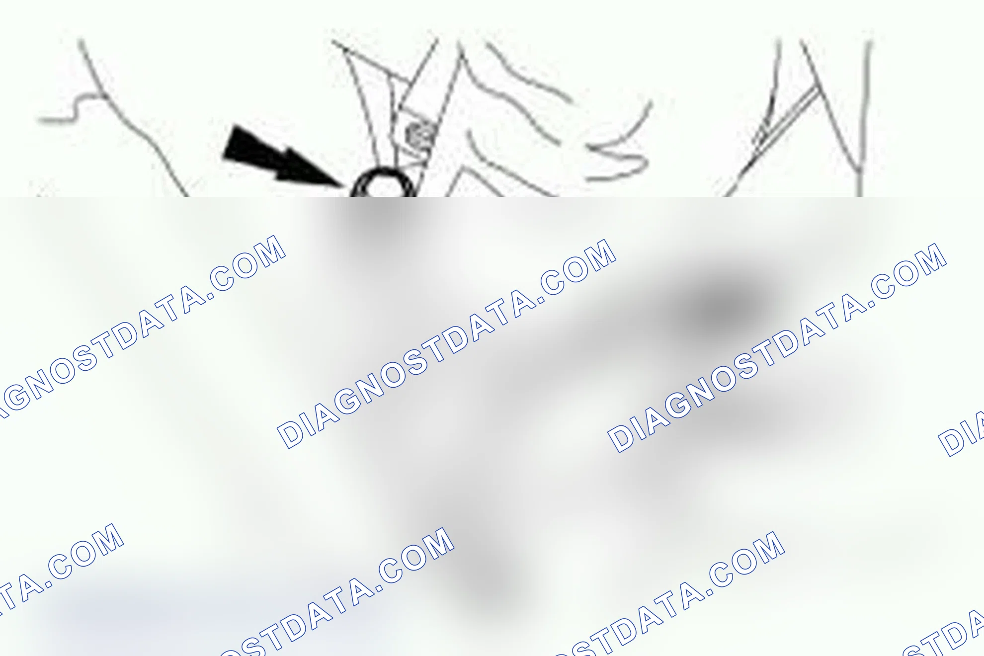 Scheme 10: Removal