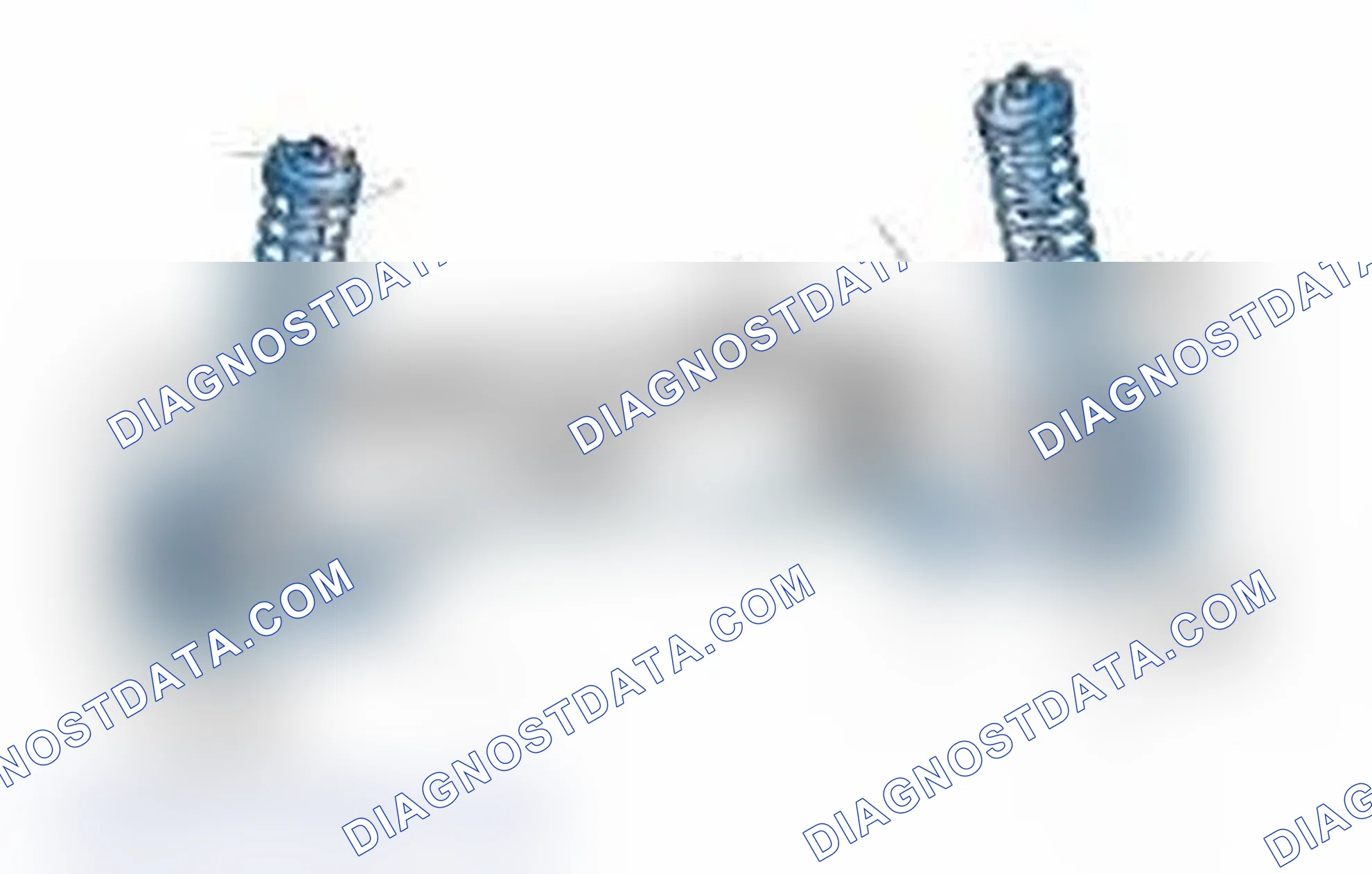 Scheme 25: Typical Front Suspension & Steering Components