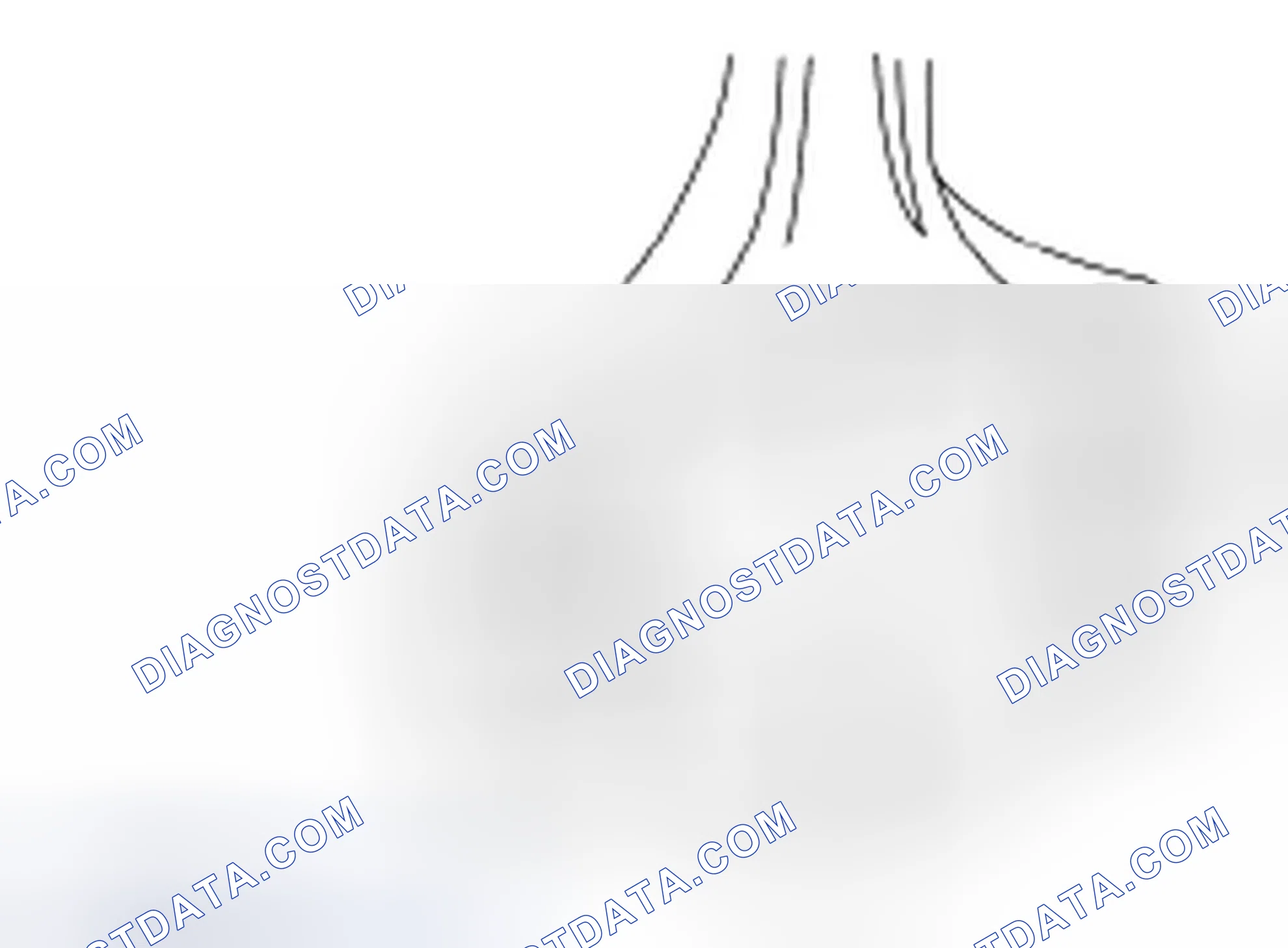 Scheme 62: Connecting Rod Large End Bore