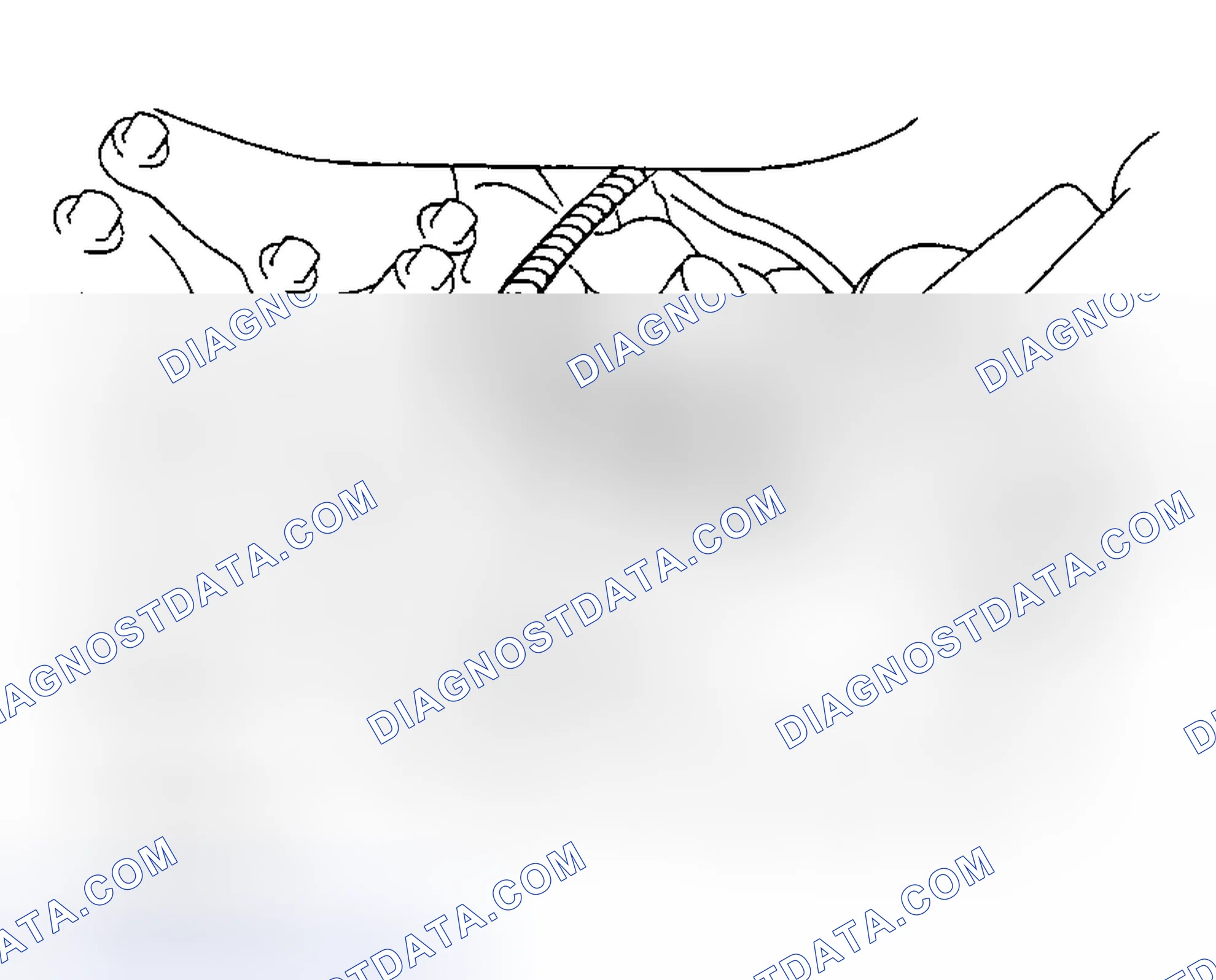Scheme 139: Removal & Installation