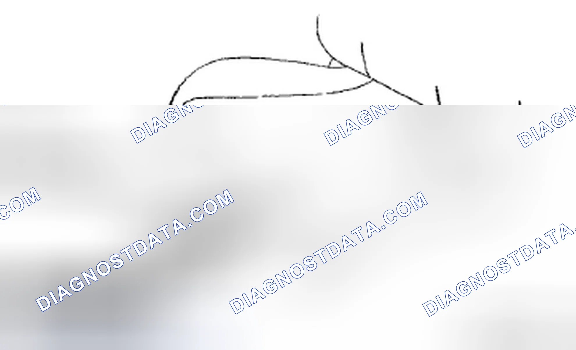Scheme 40: Side Air Bag Module