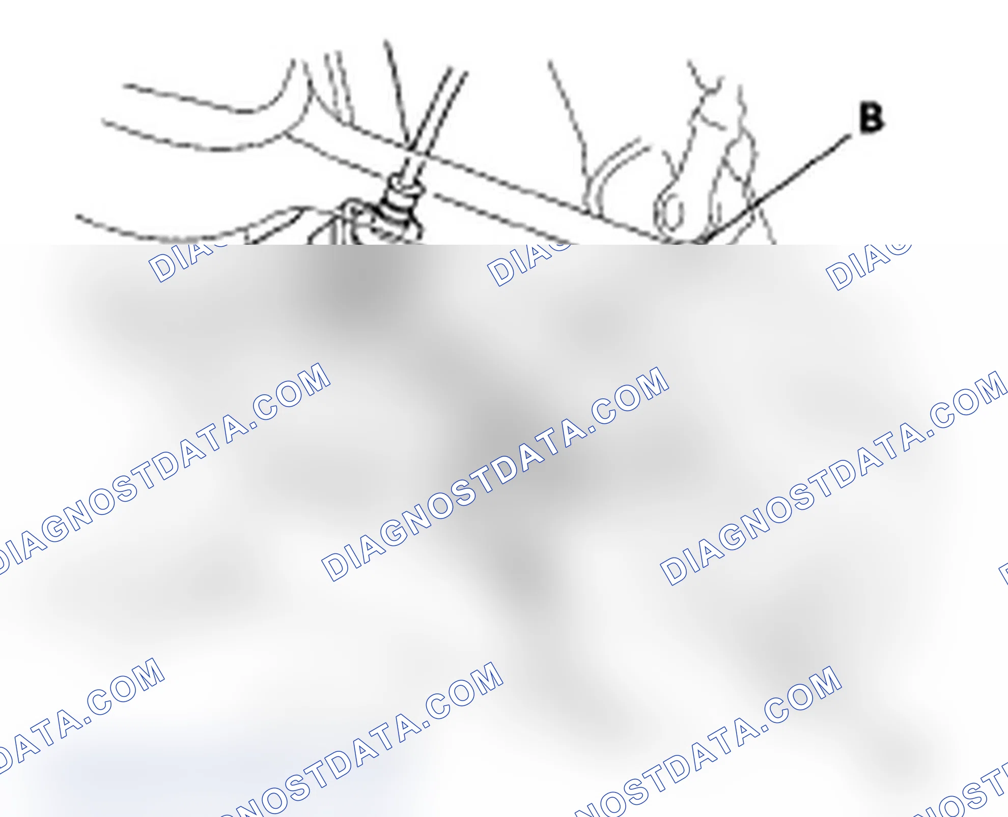 Scheme 18: Upper Arm Replacement