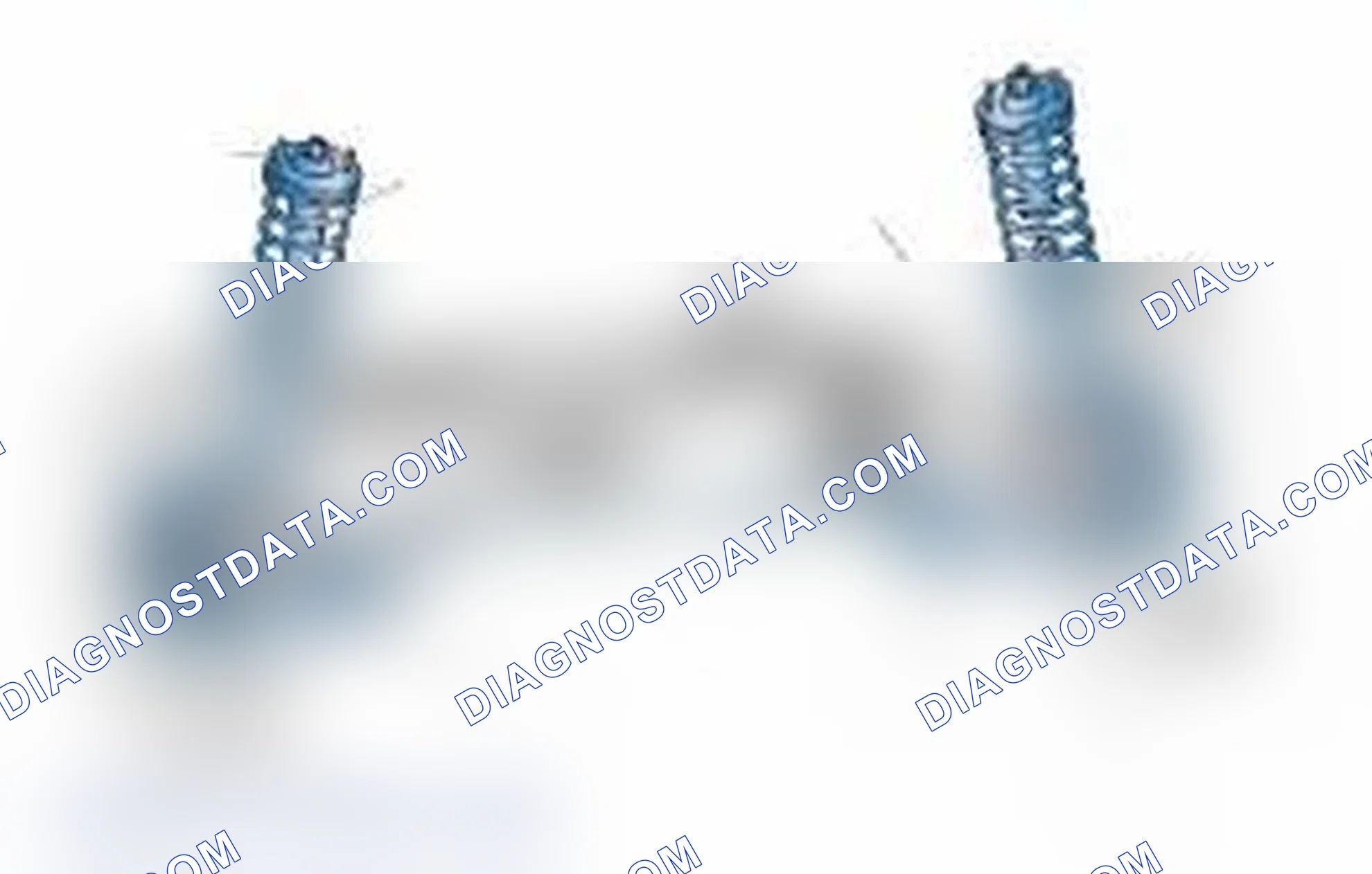 Scheme 25: Typical Front Suspension & Steering Components