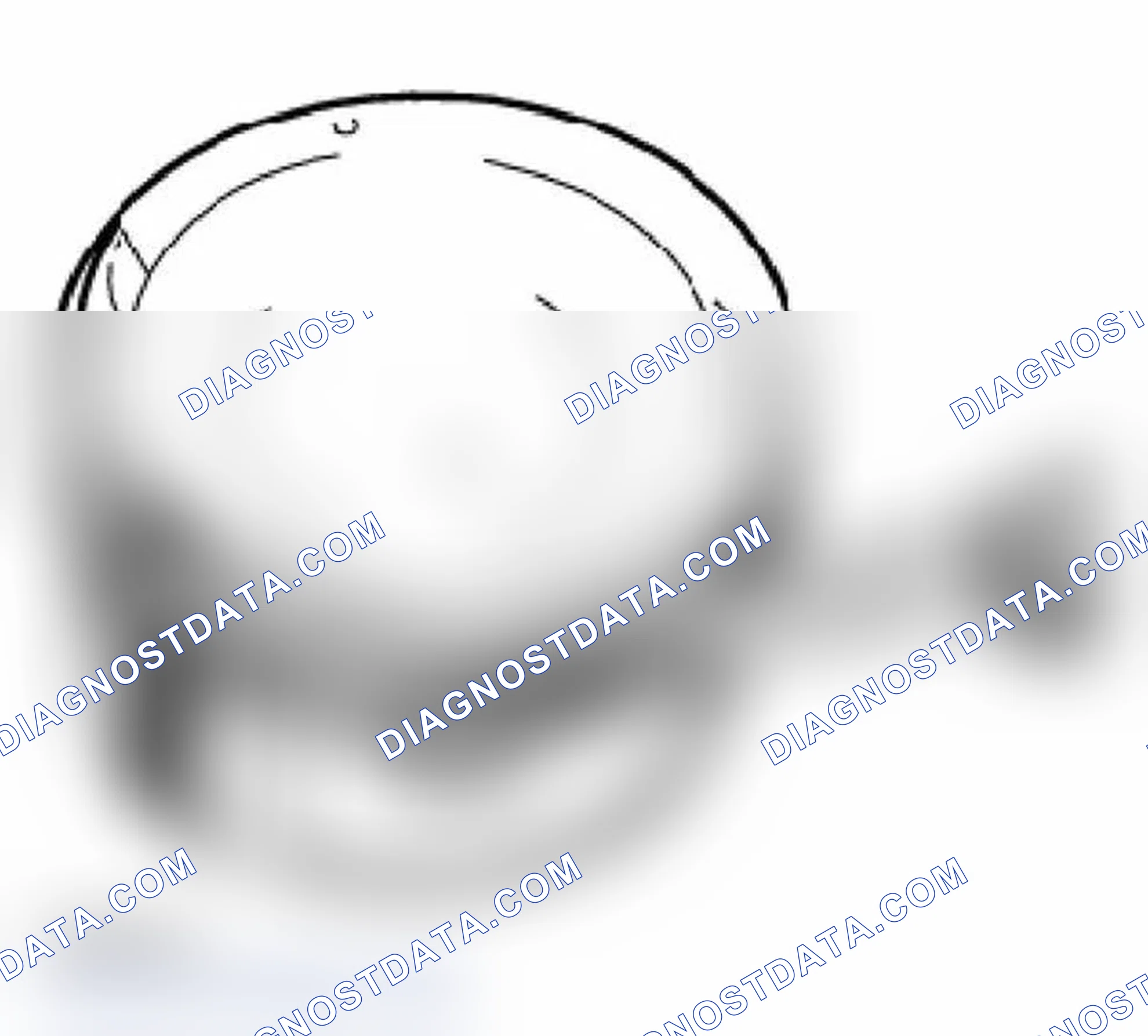Scheme 20: Piston Ring Measurements