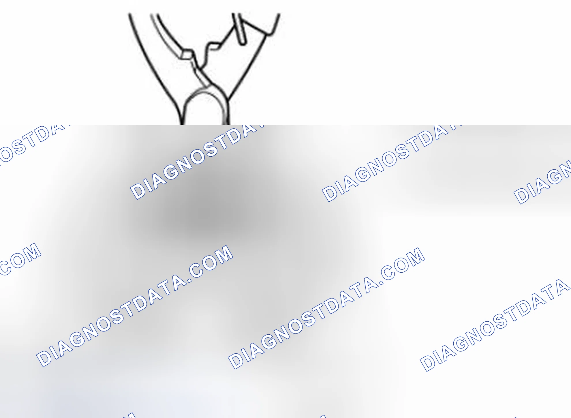 Scheme 47: Snap Ring Removal/Installation Note