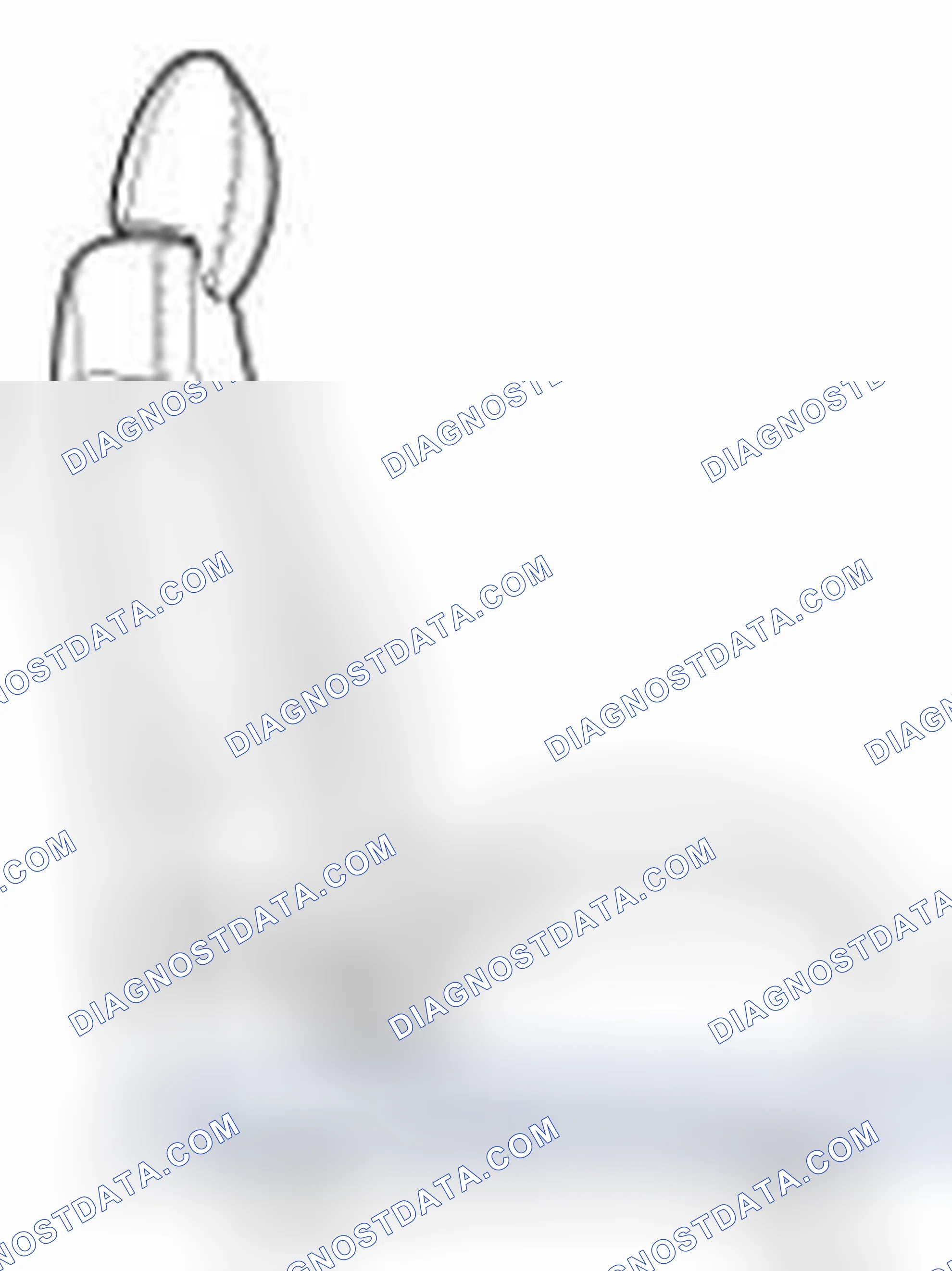 Scheme 10: REMOVAL