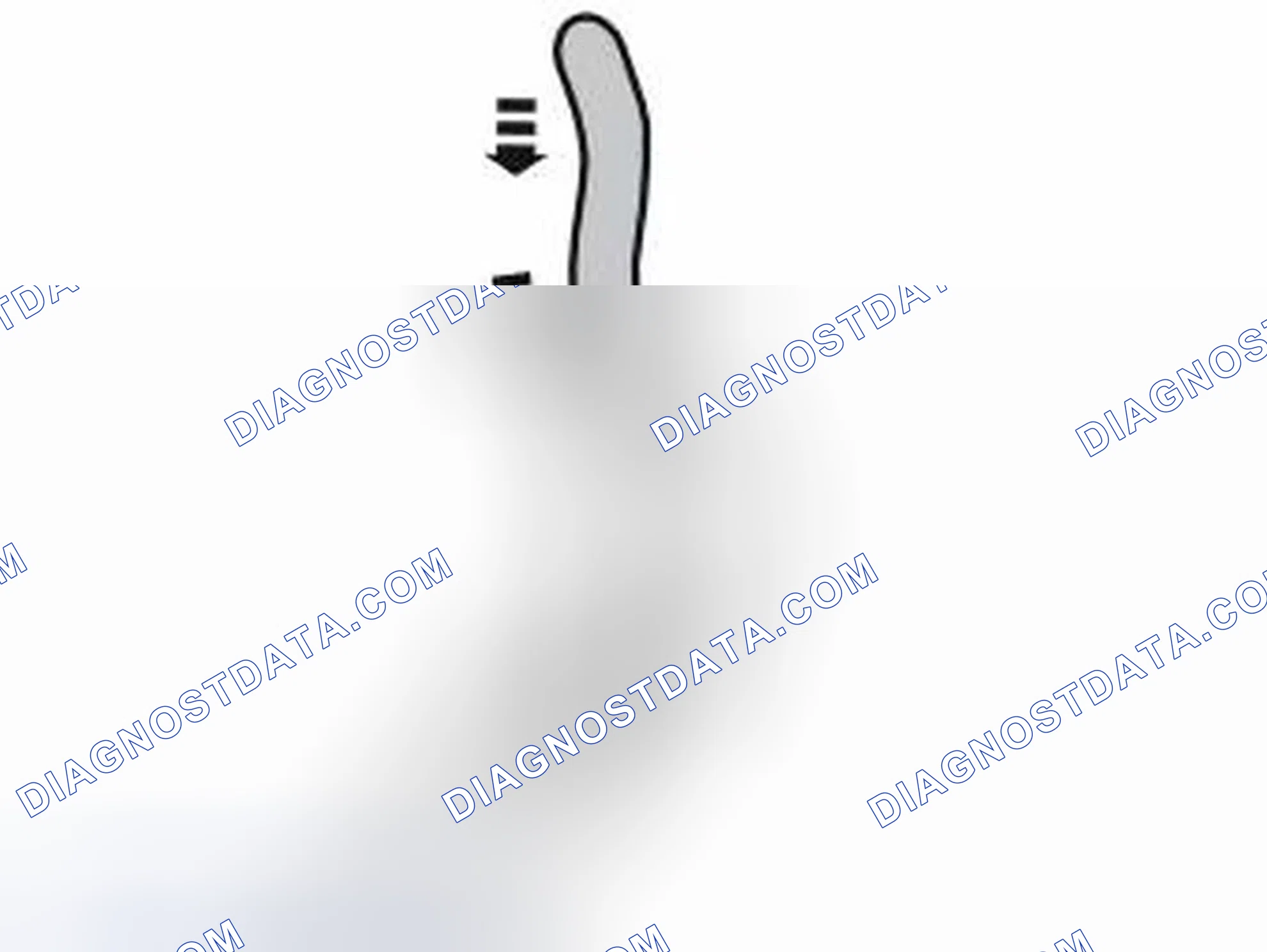 Scheme 33: INSTALL BRACKET