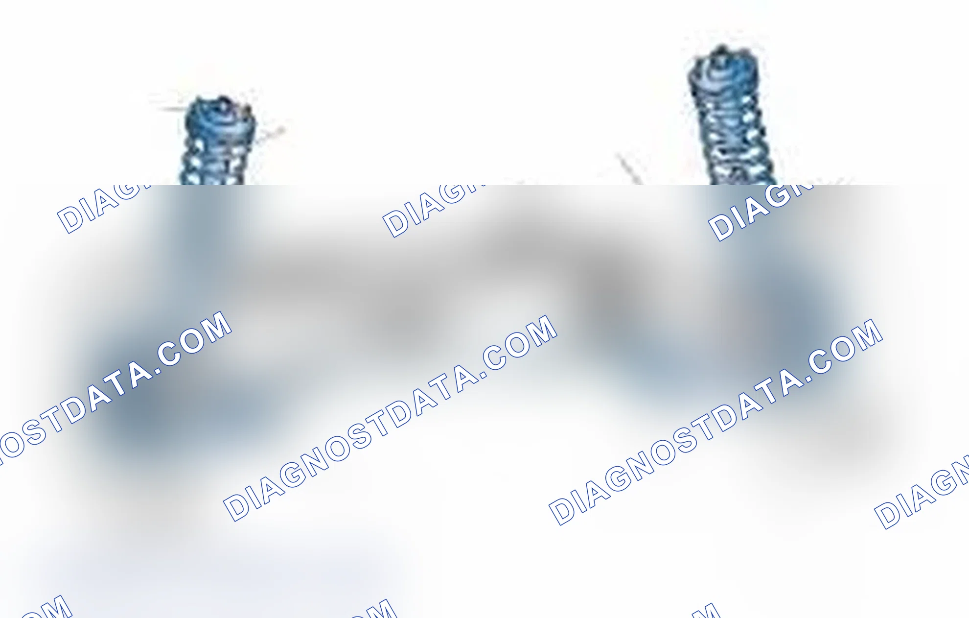 Scheme 25: Typical Front Suspension & Steering Components