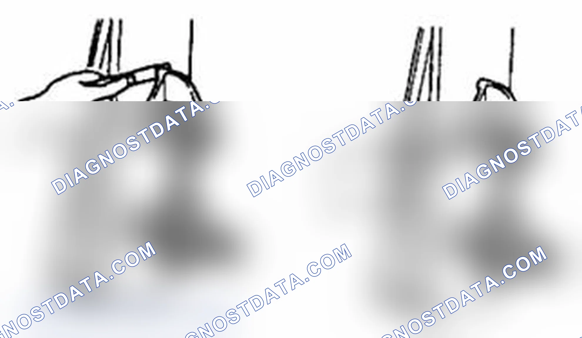 Scheme 167: Connecting rod alignment