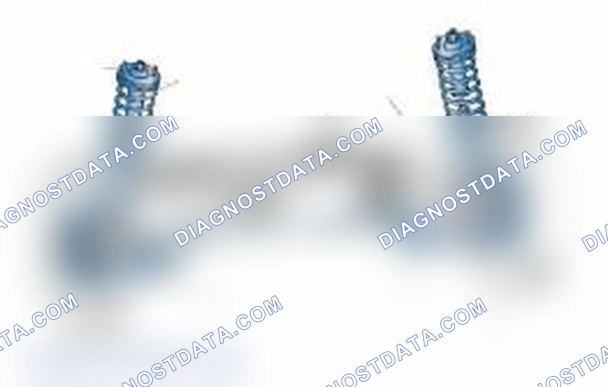 Scheme 25: Typical Front Suspension & Steering Components