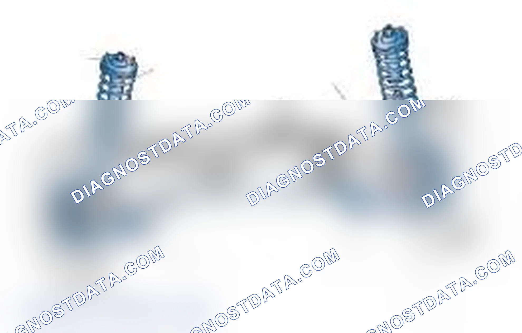 Scheme 25: Typical Front Suspension & Steering Components