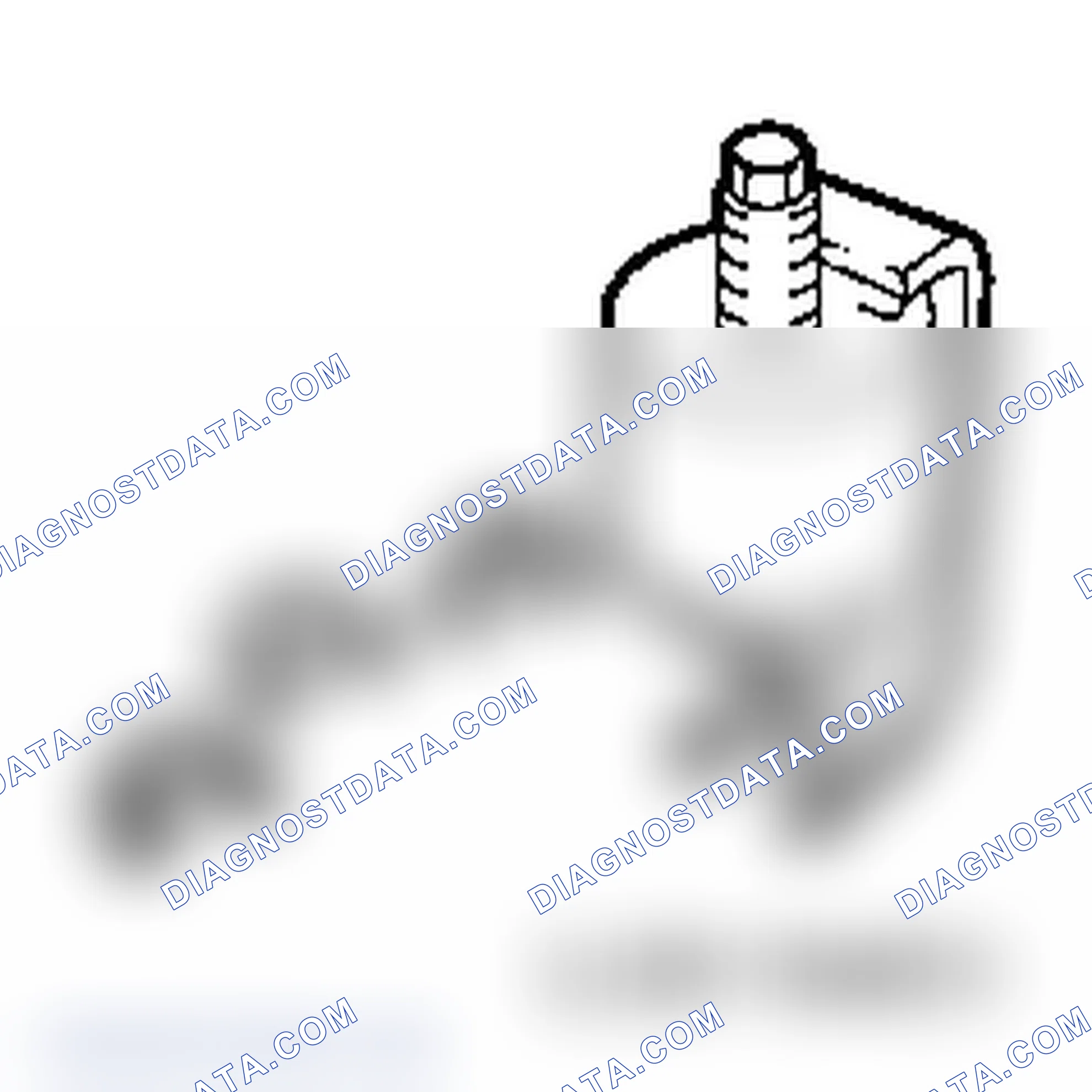 Special Tools (A17DTS)