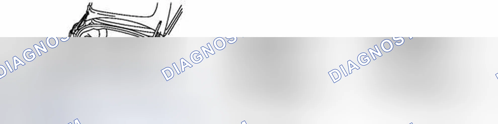 Scheme 152: REMOVAL