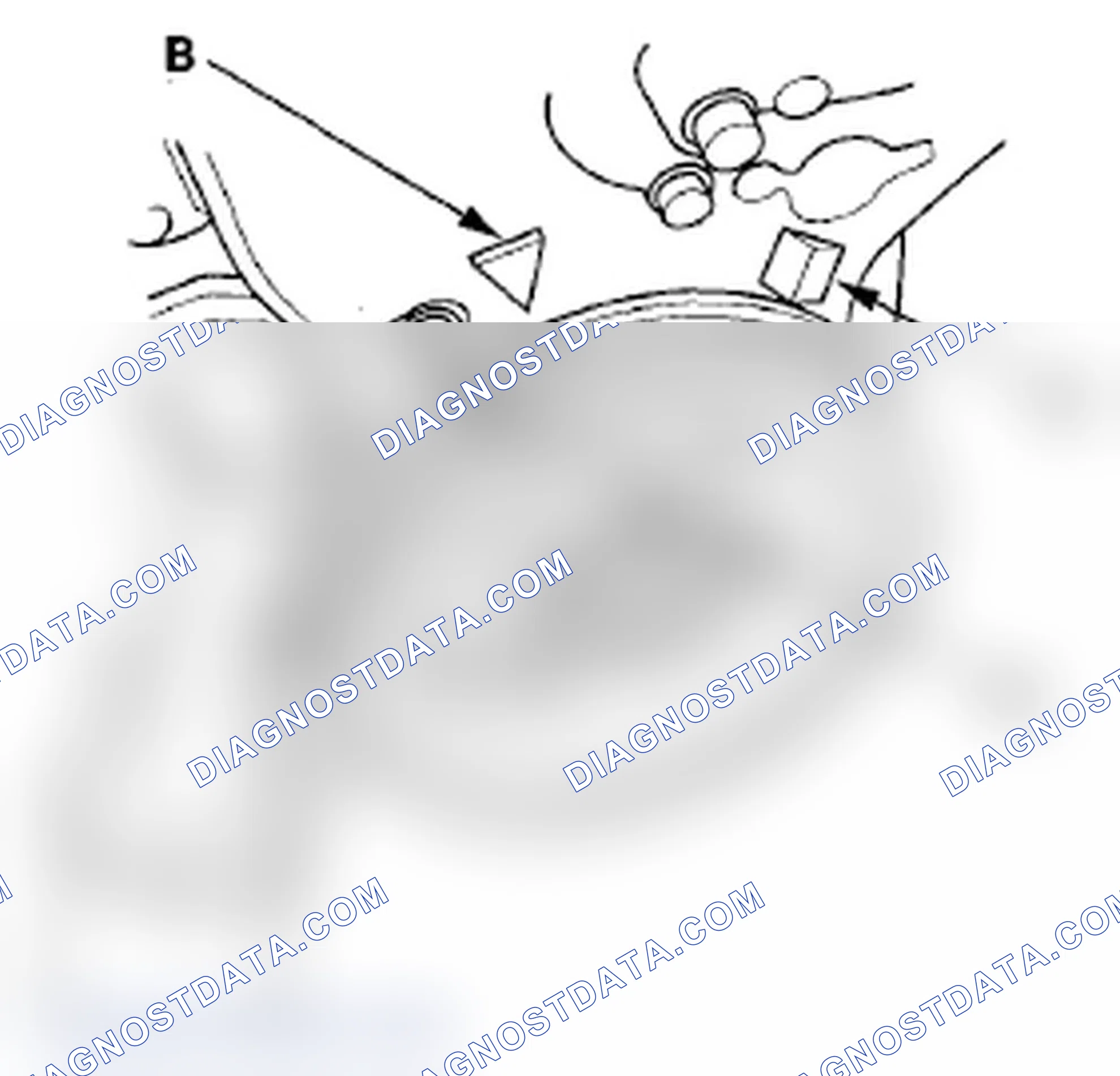 Scheme 49: Timing Belt Removal