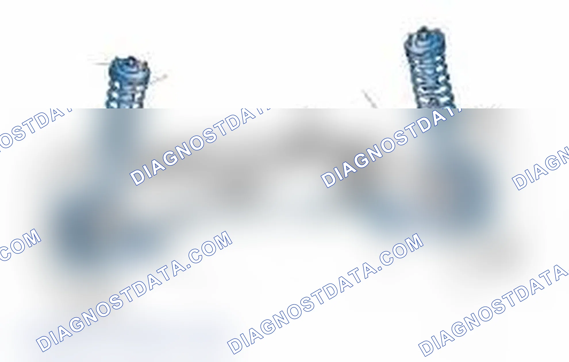 Scheme 25: Typical Front Suspension & Steering Components