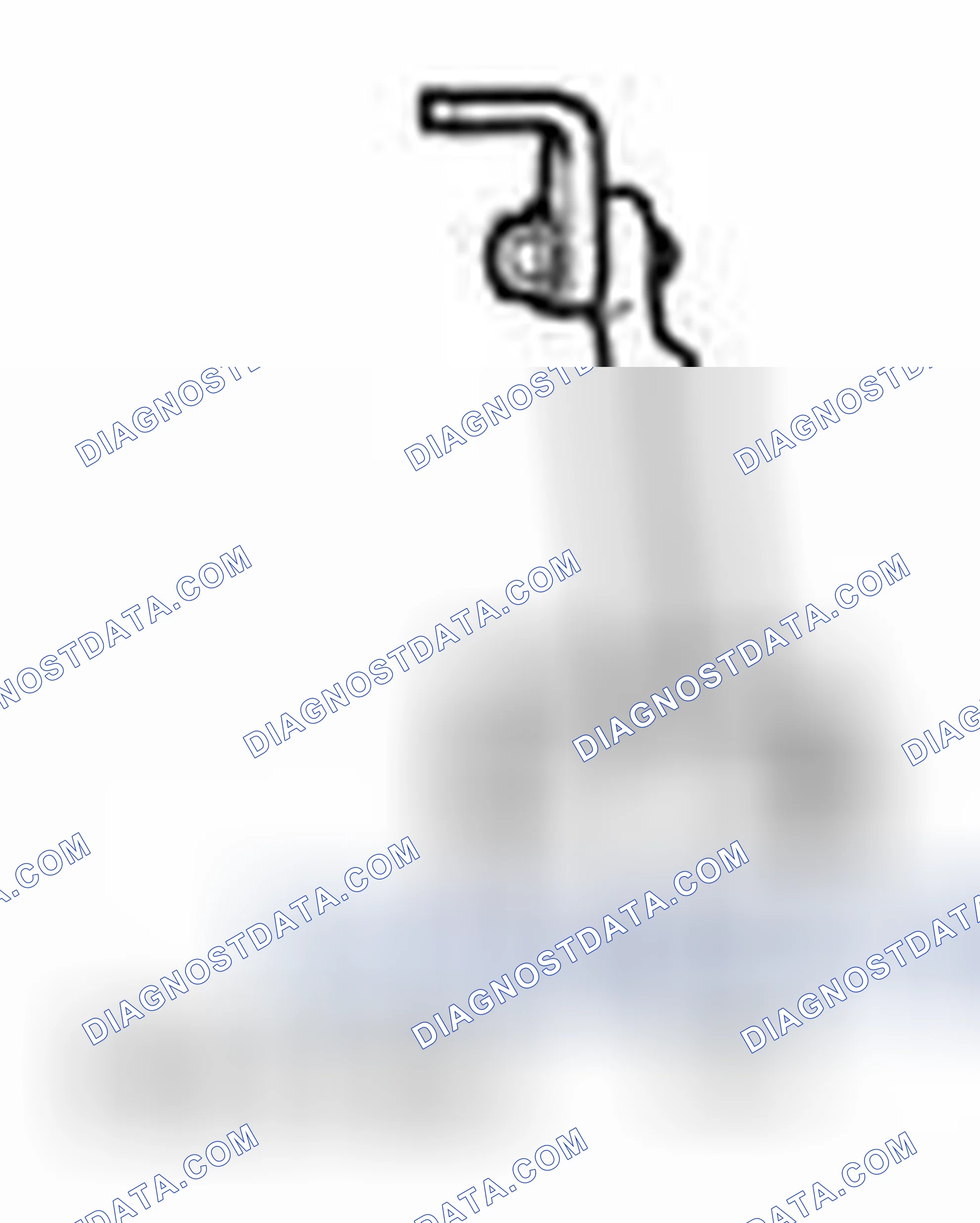 Scheme 420: Engine