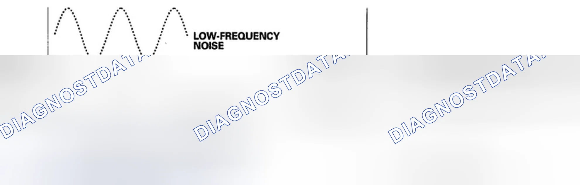 Scheme 33: Active Noise Cancellation (ANC) System