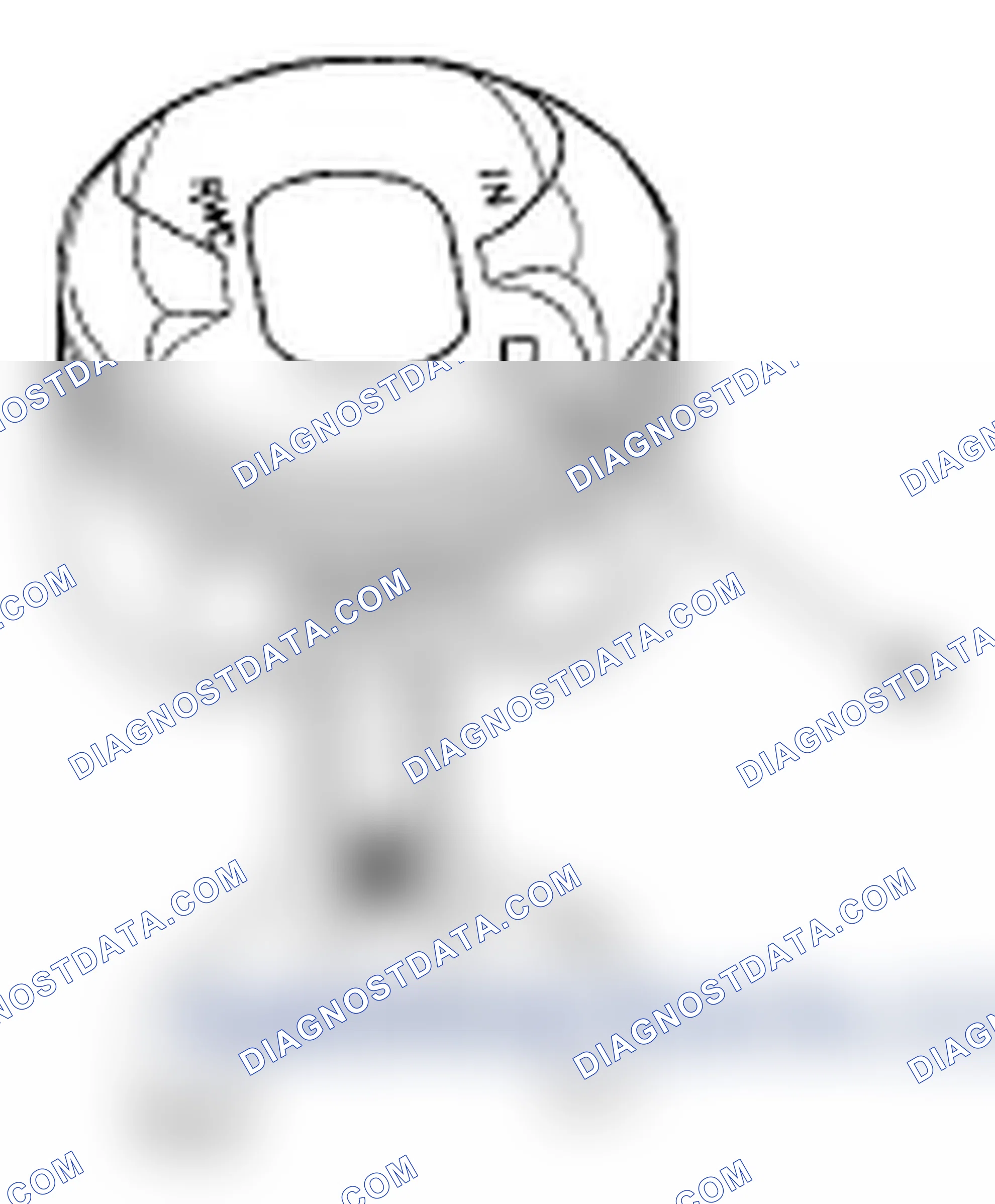 Scheme 288: If the Crankshaft is Already Installed