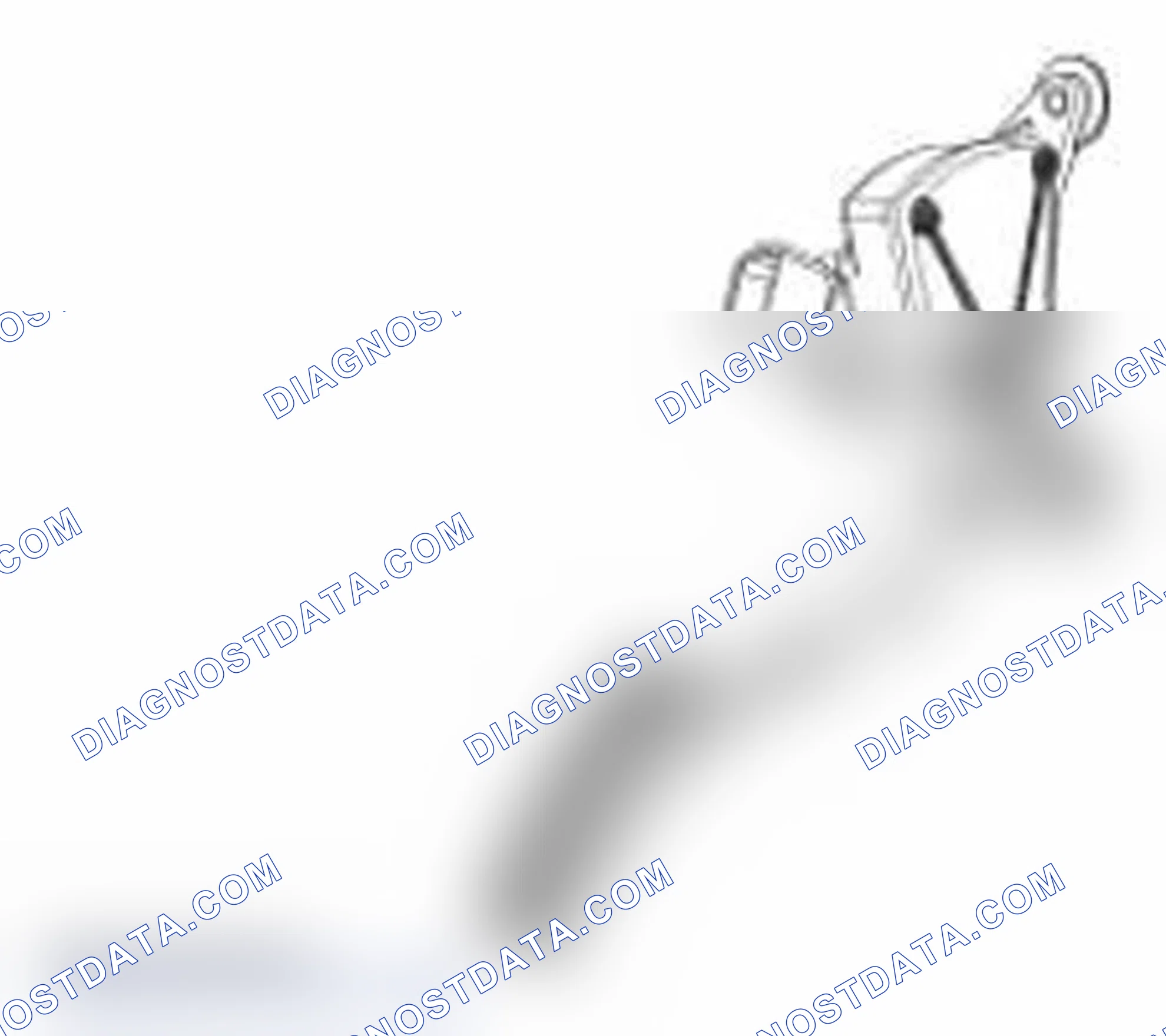 Scheme 71: 3 Track APP Sensor