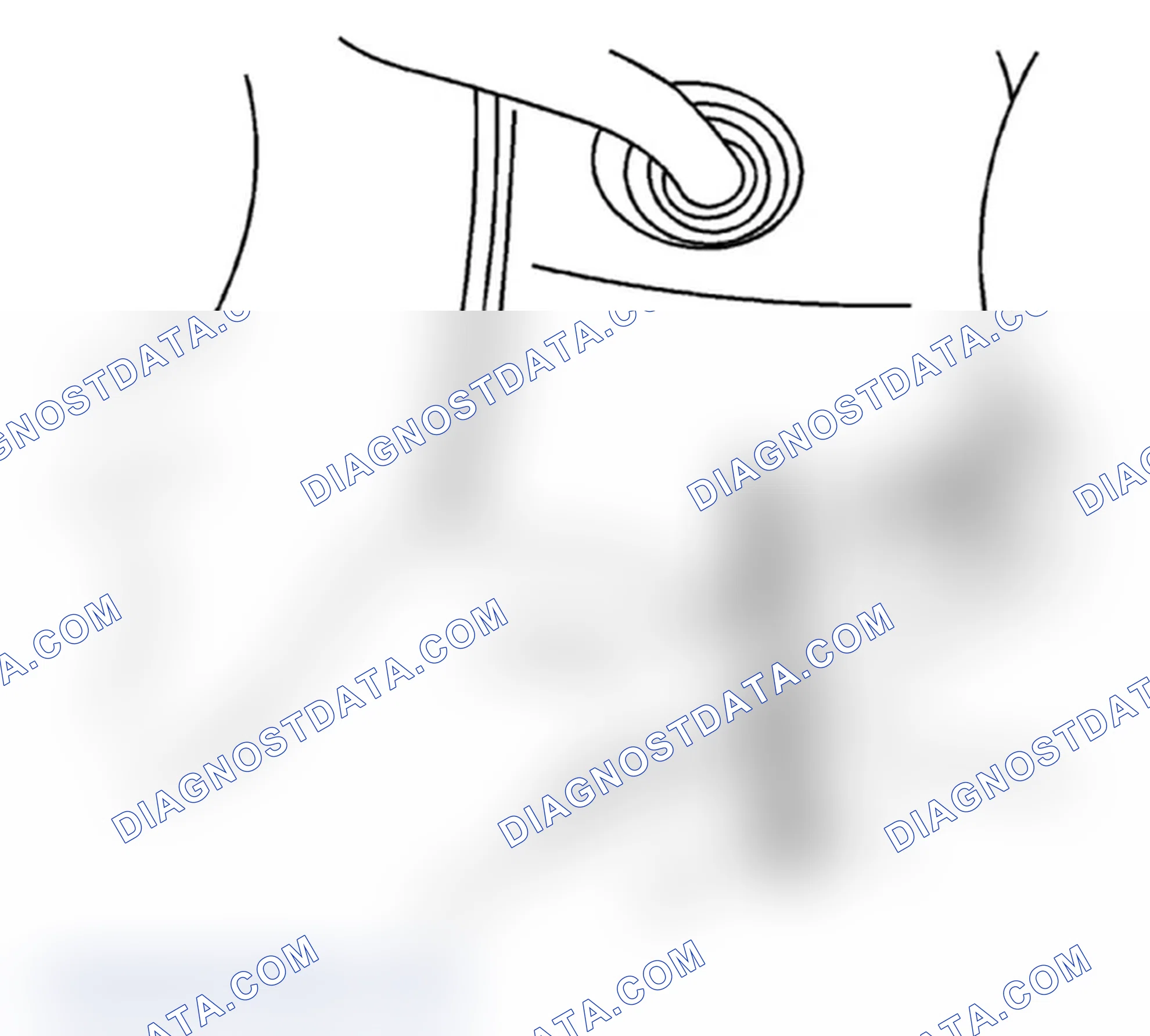 Scheme 14: Installation Procedure
