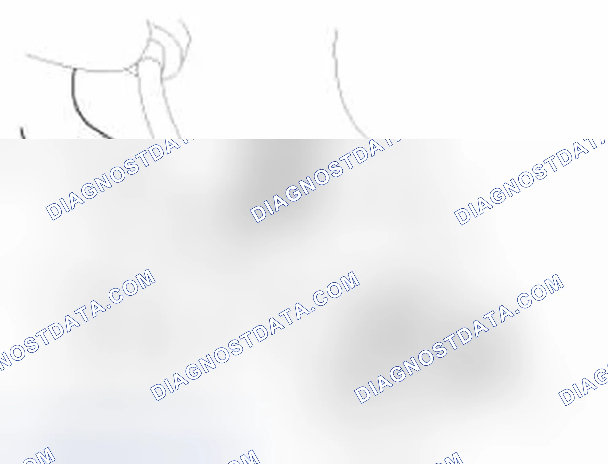 Scheme 441: Removal