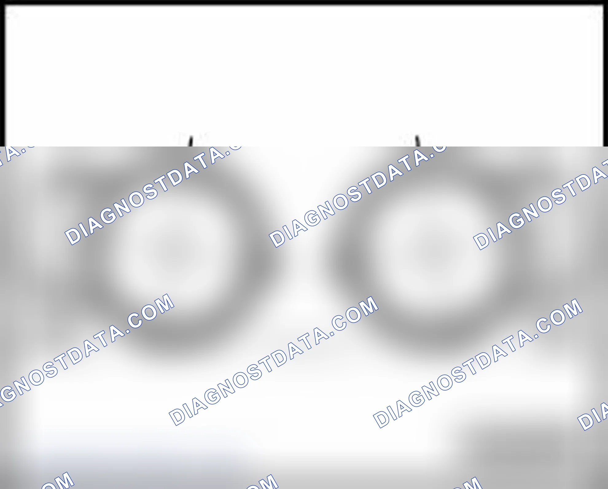 Scheme 400: Installed position of rear clamping sleeves