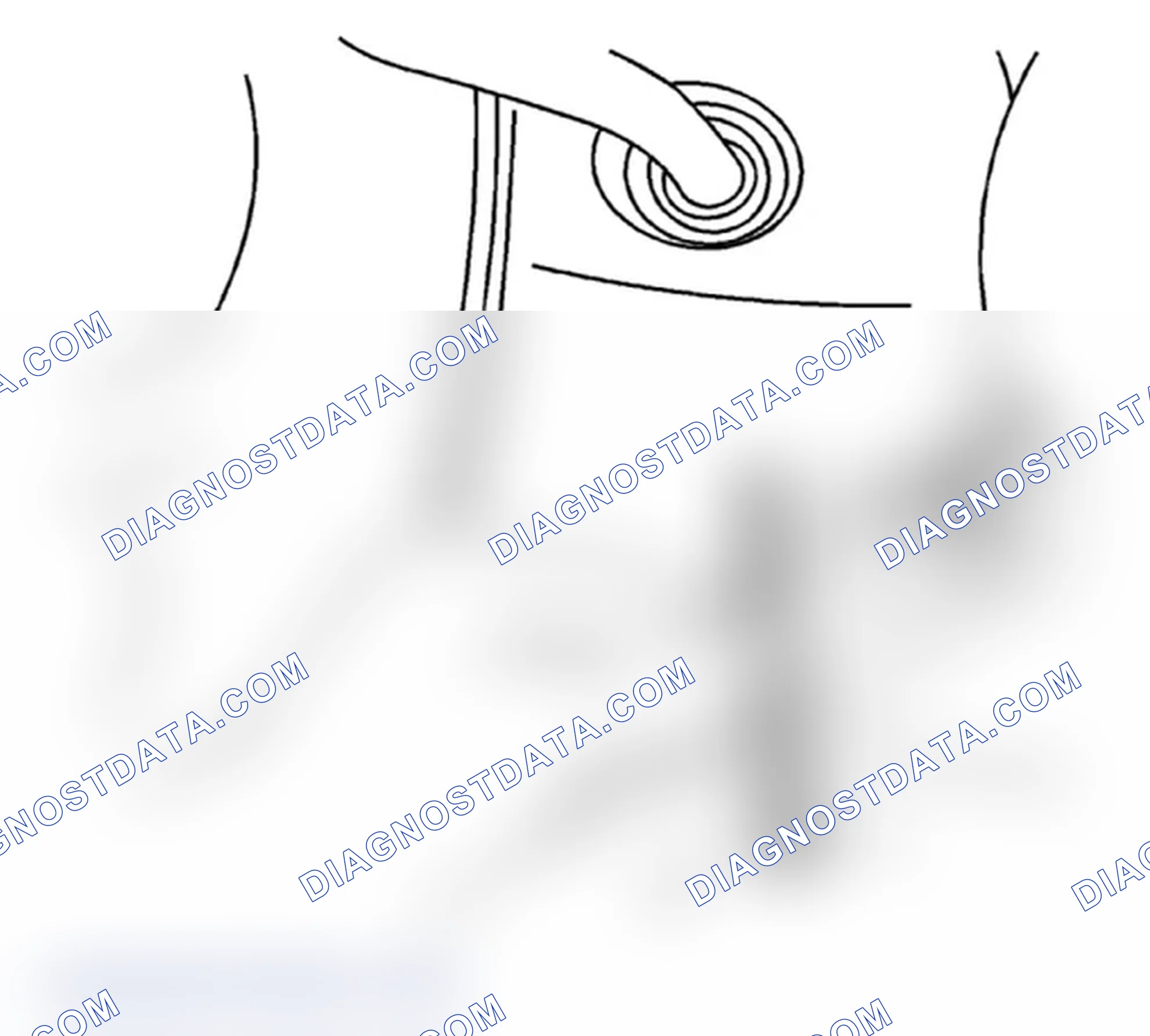 Scheme 14: Installation Procedure