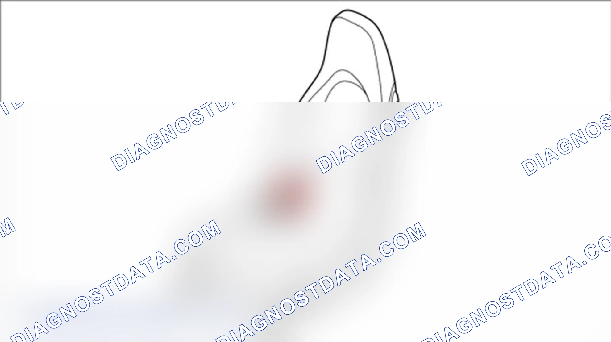Scheme 170: Removing backrest side support