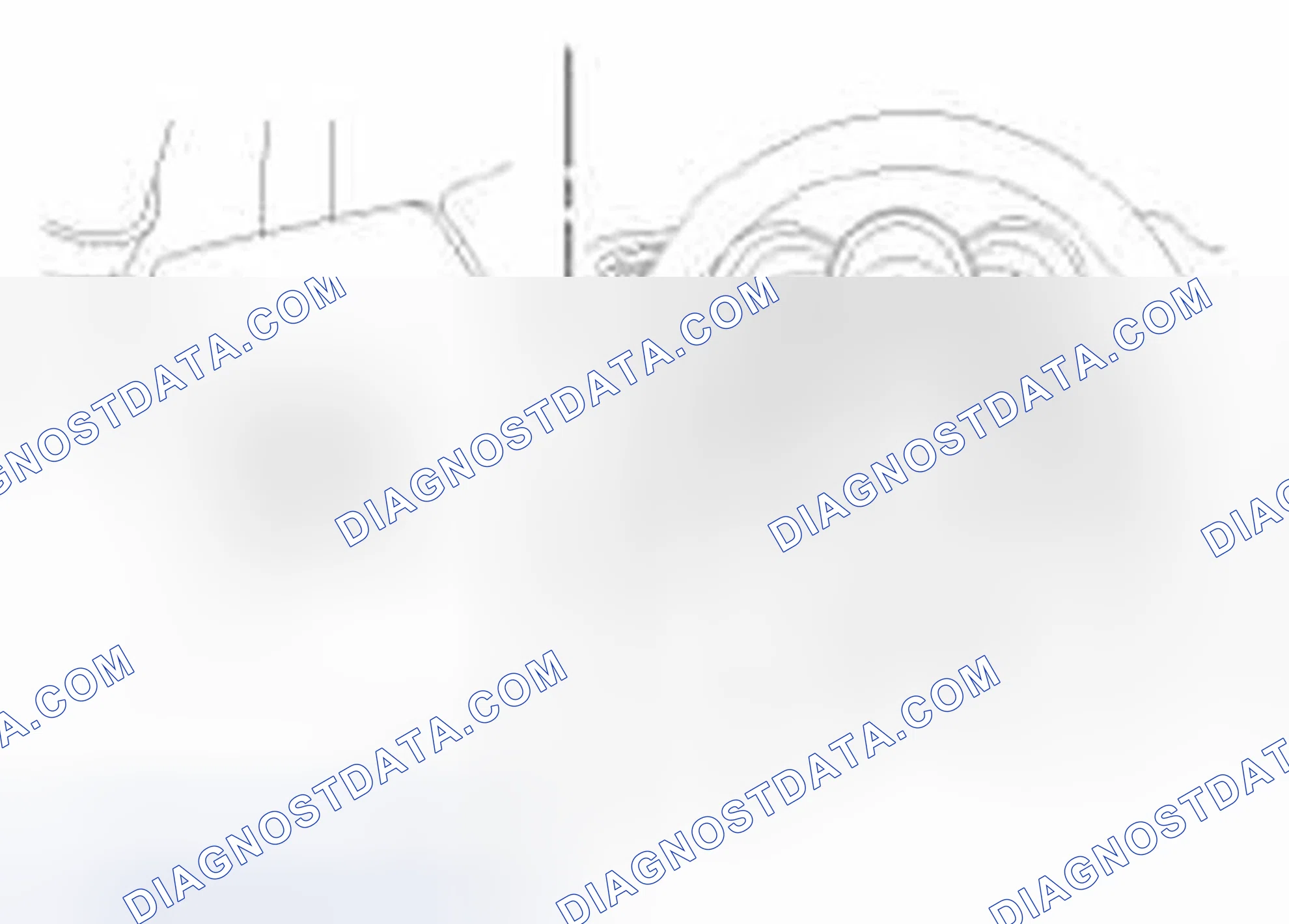 Scheme 2: Removal