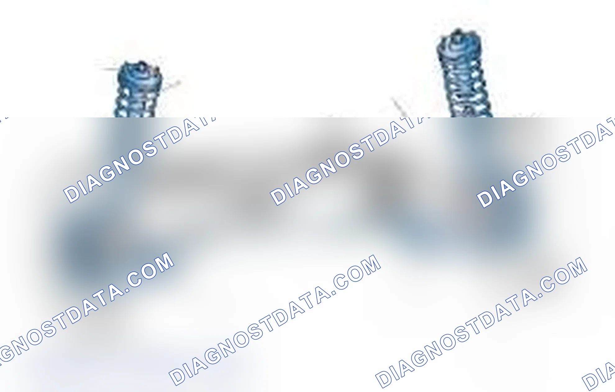 Scheme 25: Typical Front Suspension & Steering Components