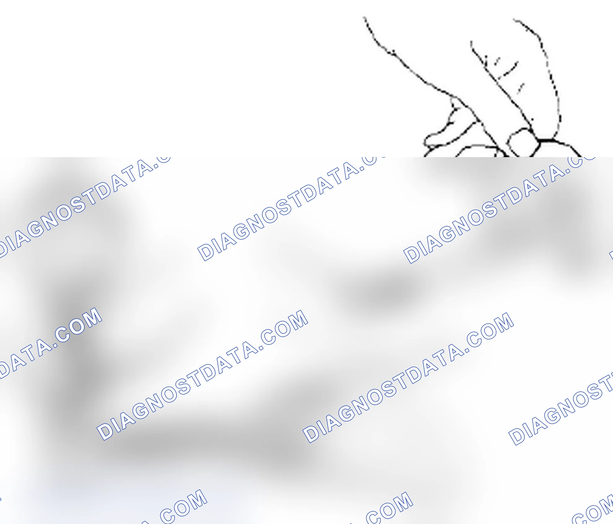 Scheme 175: Piston Pins