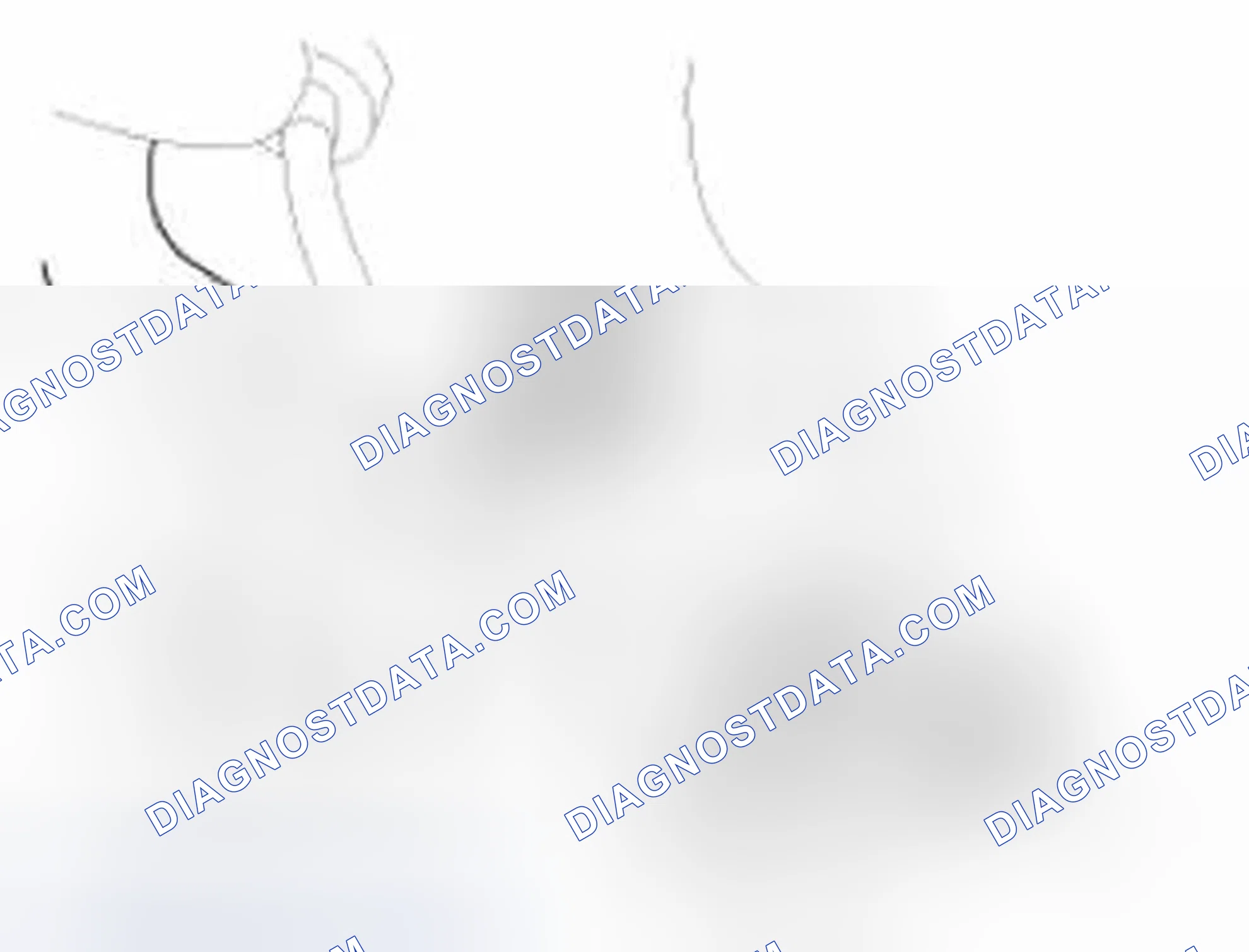 Scheme 138: Removal