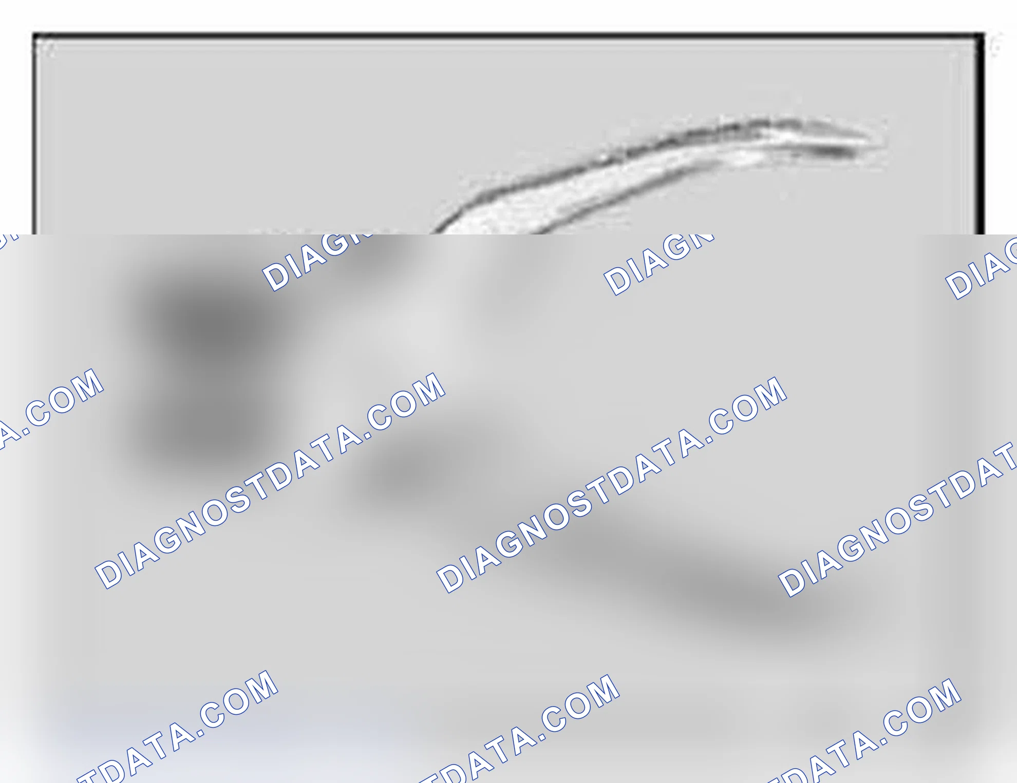 Scheme 296: 61 1 190 Pliers
