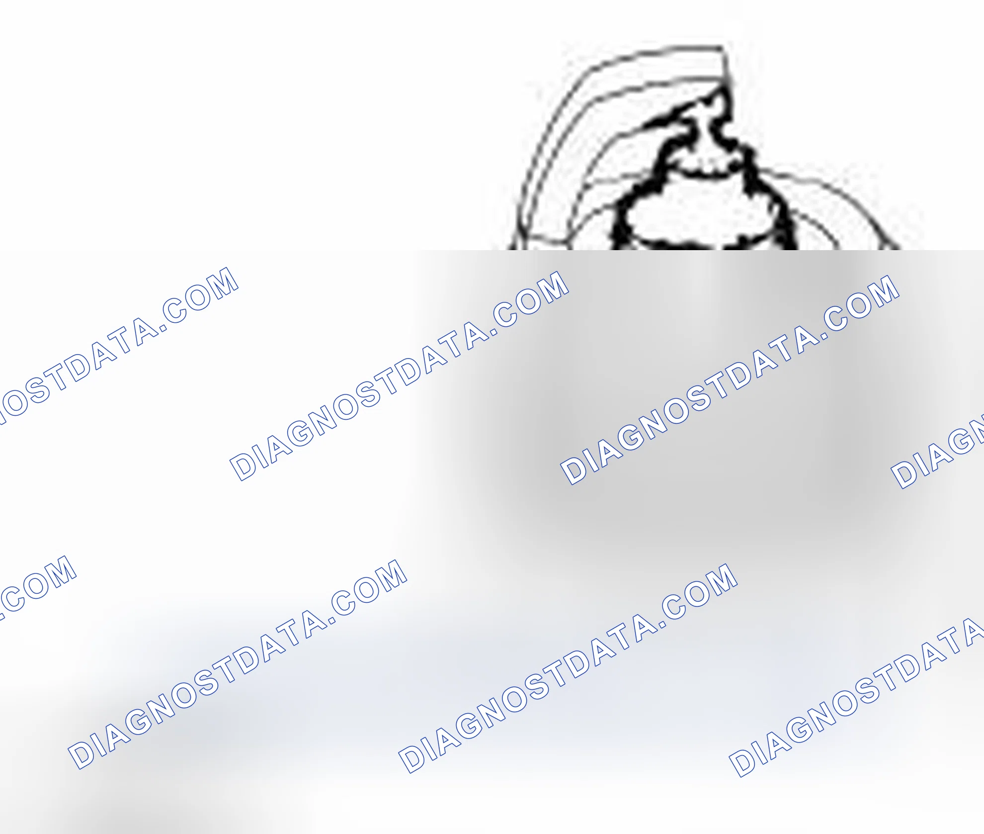 Scheme 1451: Spark Plug Inspection