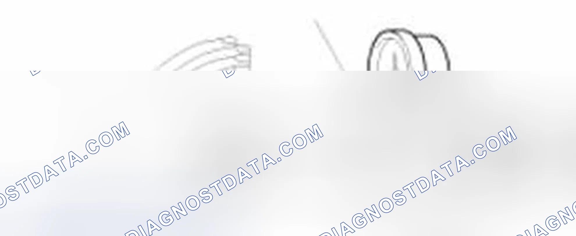 Scheme 34: Radiator Cap Testing