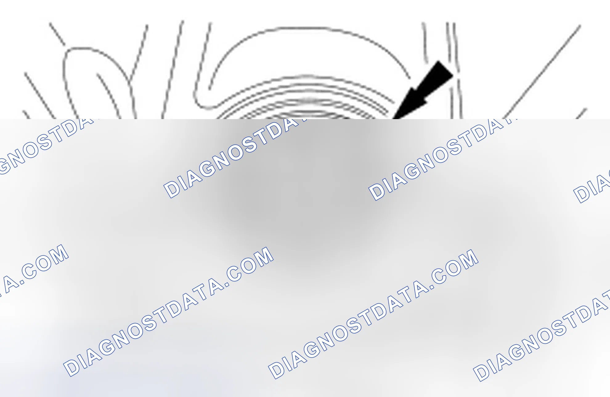 Scheme 289: Removal