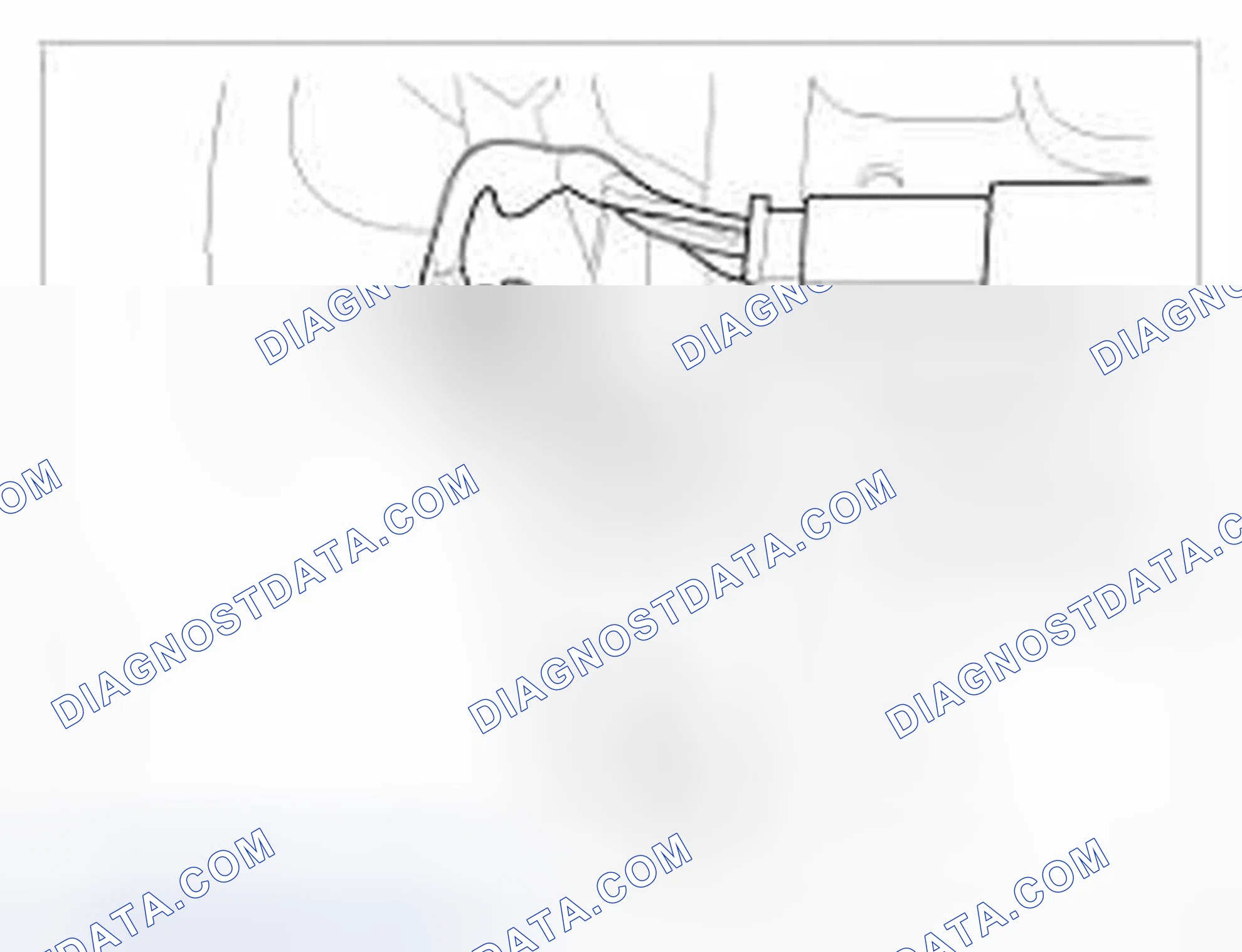 Scheme 6: Bluetooth [Lower]