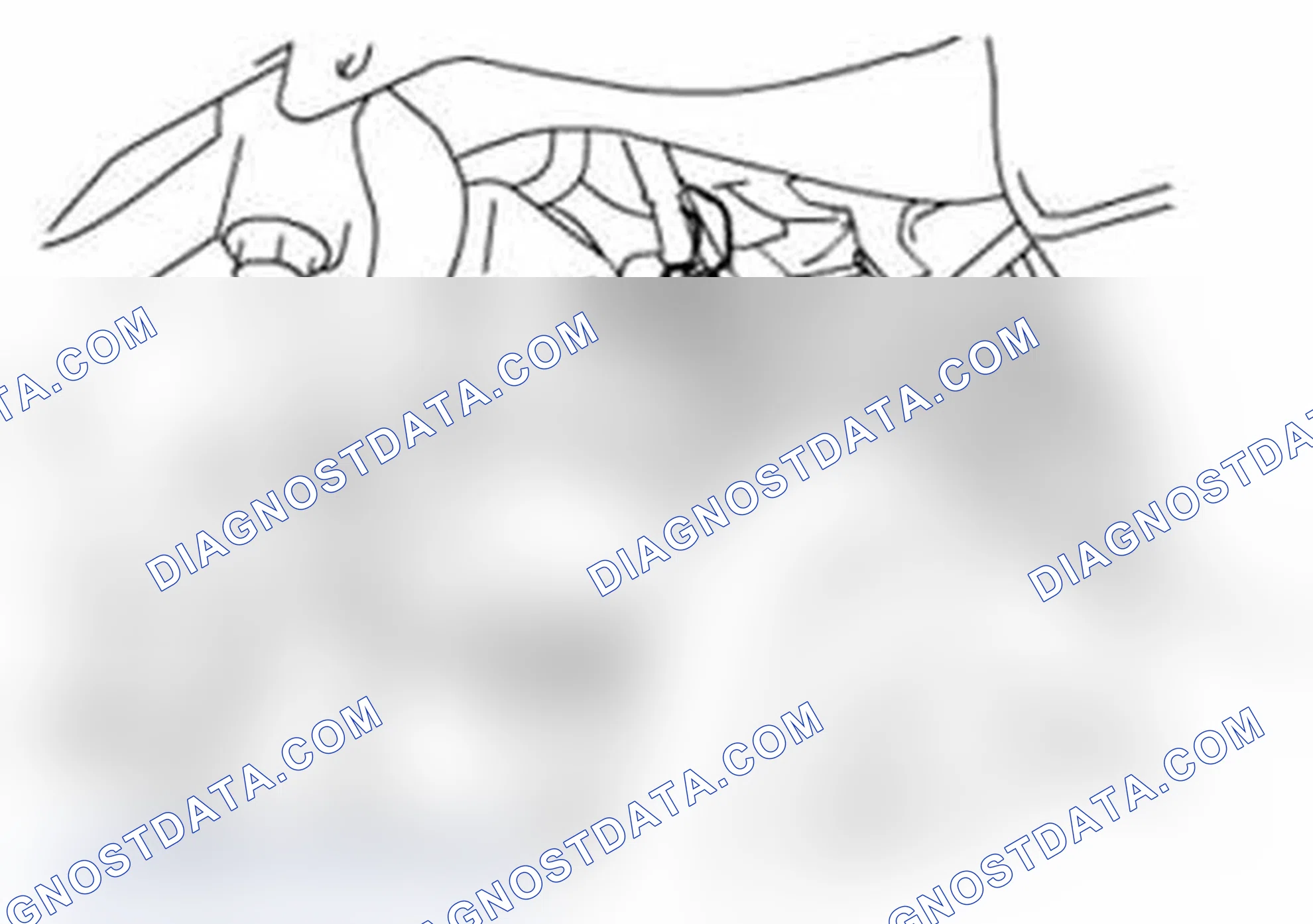 Scheme 87: Crankshaft Position (CKP) Sensor On-Vehicle Inspection