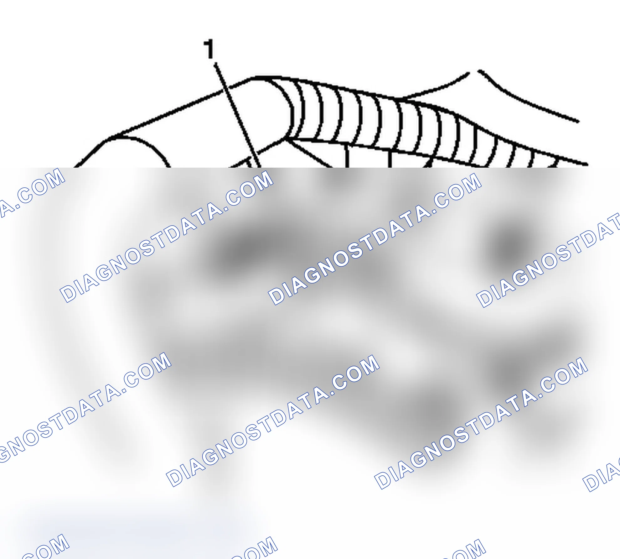 Scheme 15: Removal Procedure