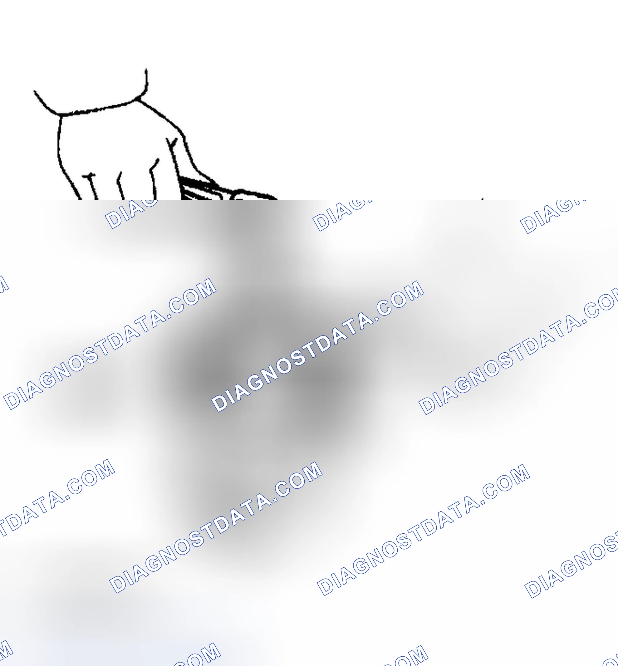 Scheme 215: DISASSEMBLY