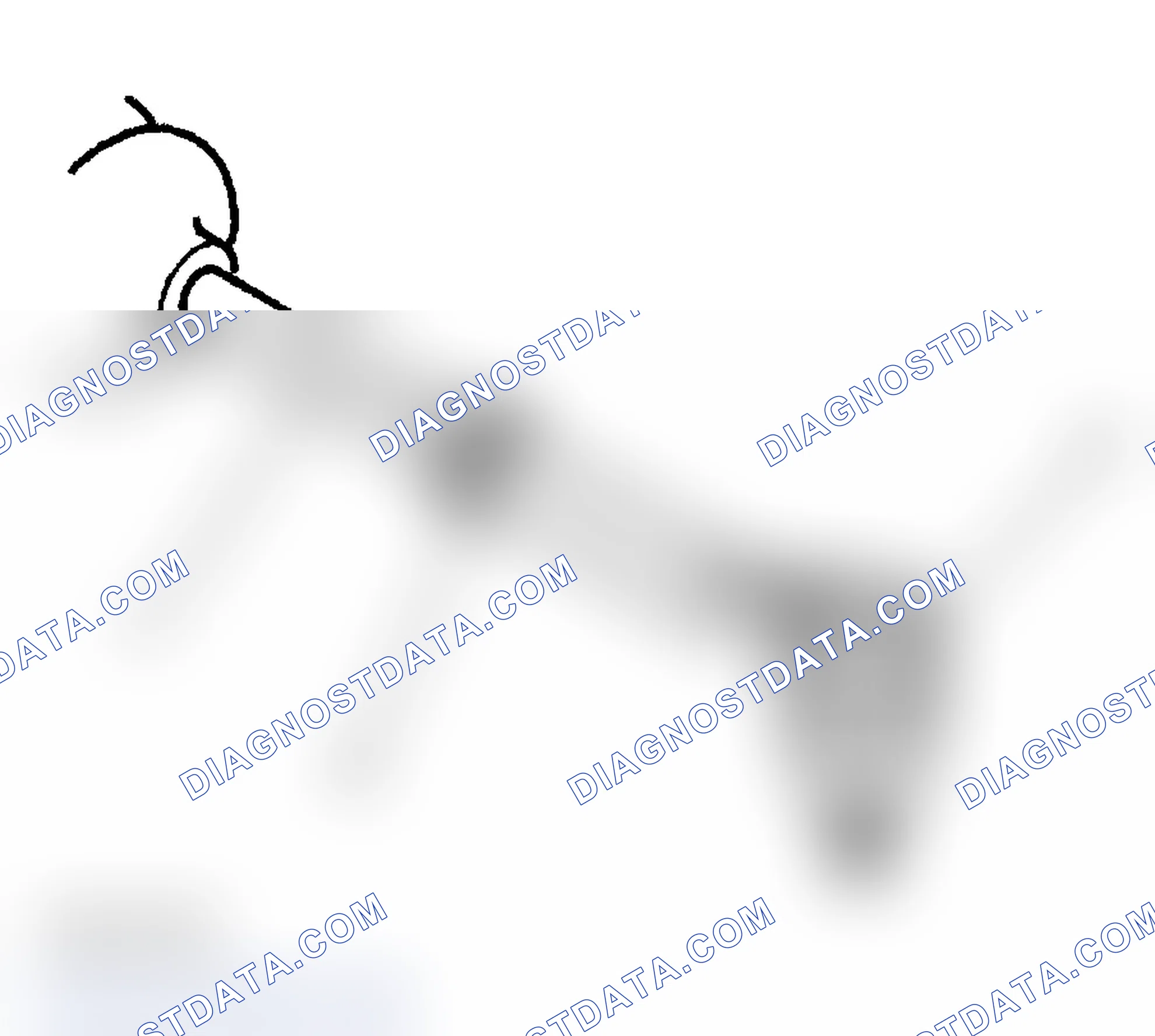Scheme 19: Front Toe Adjustment