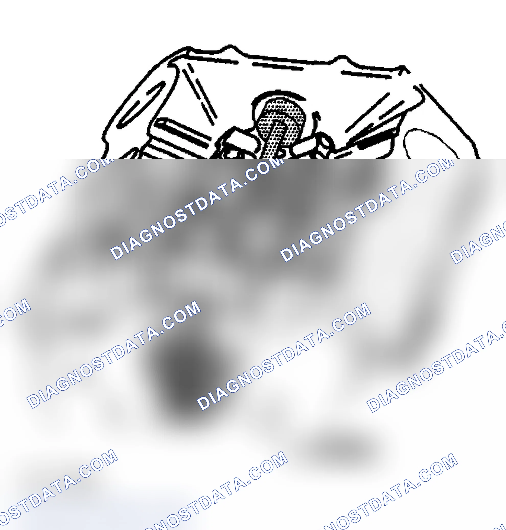 Scheme 225: Balance Shaft Bearing And/Or Bushing Removal