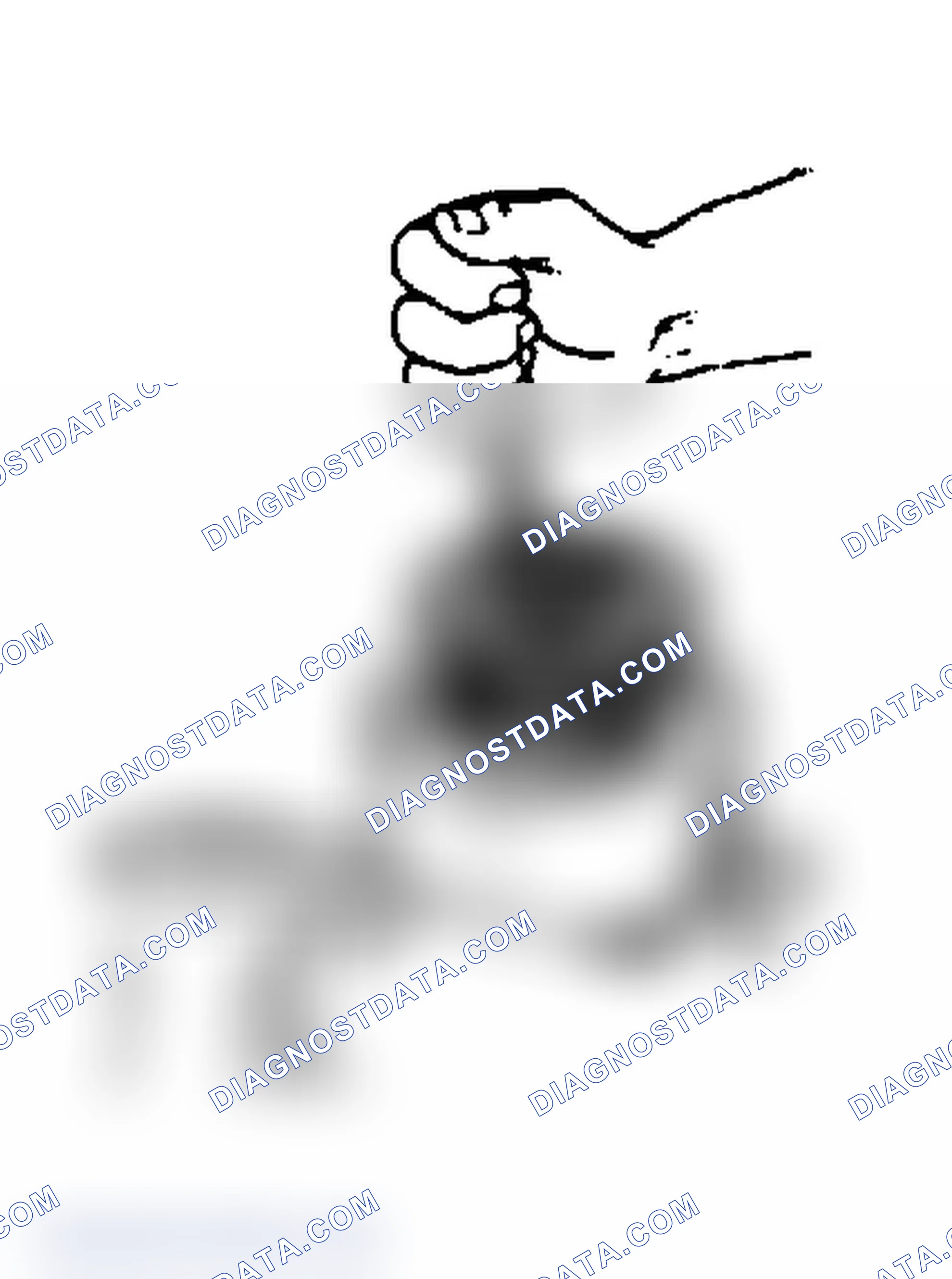 Scheme 16: Removing Snap Ring