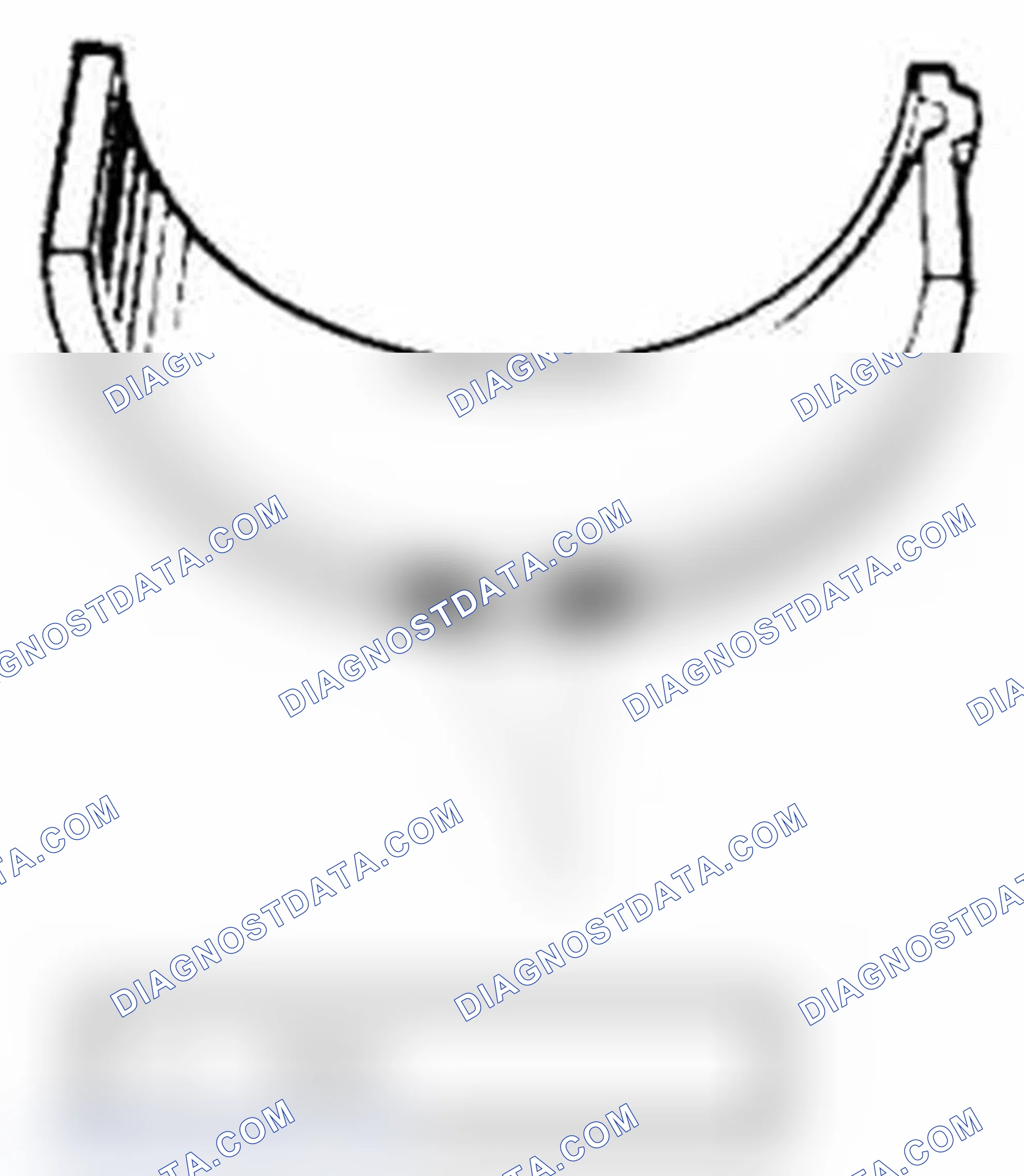 Scheme 200: Undersize bearing (0.25 mm)