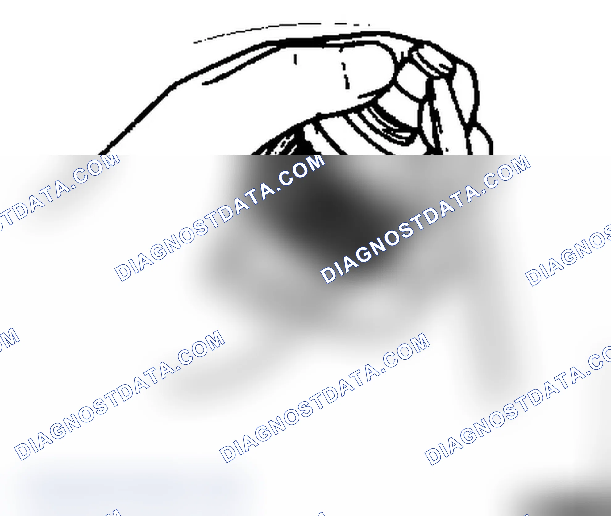 Starter Disassemble